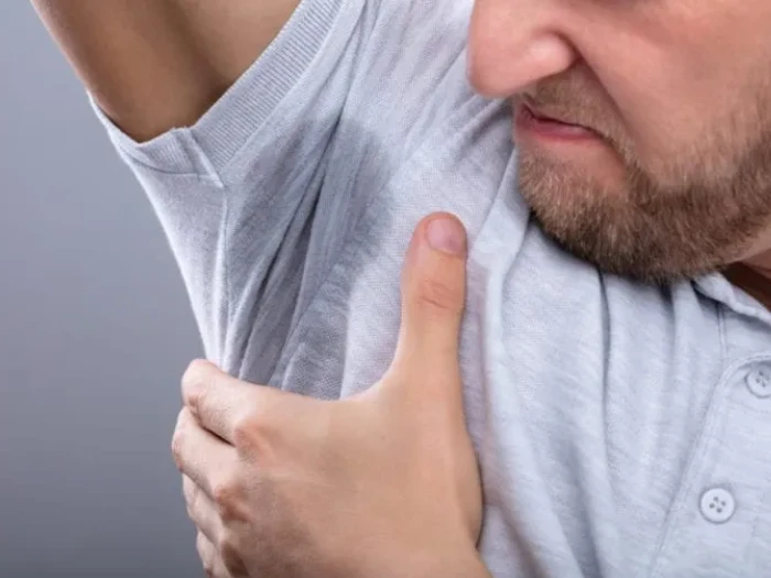 H2 Male Excessive Sweating Treatment - Perfect Doctors Clinic Male Excessive Sweating Treatment at Perfect Drs Clinic