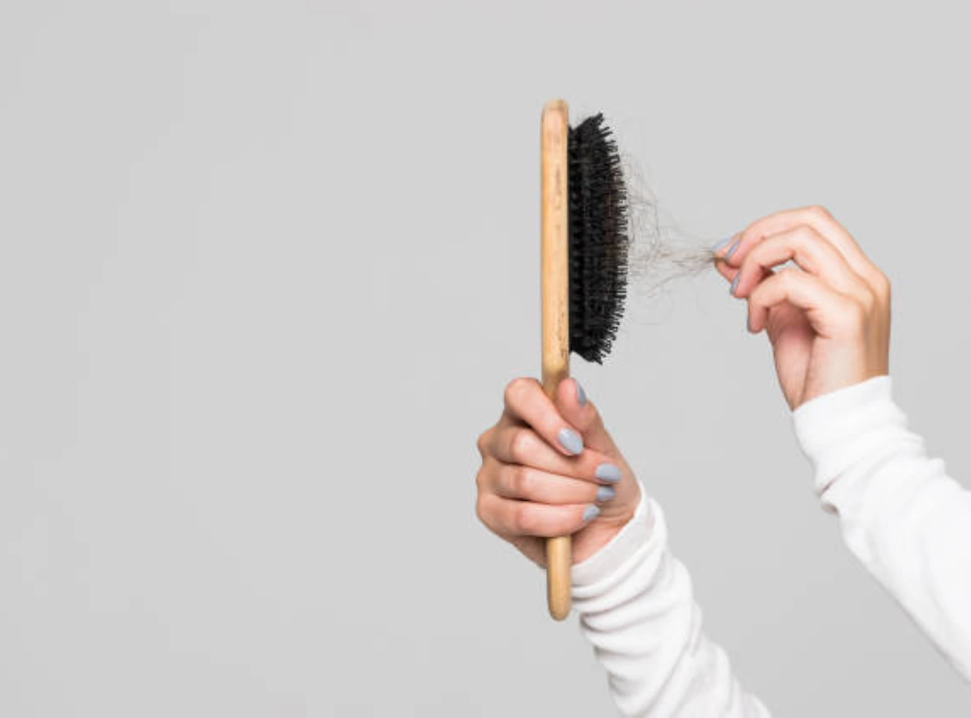 Hair Loss Treatment - Perfect Doctors Clinic Hair Loss Treatment in Dubai
