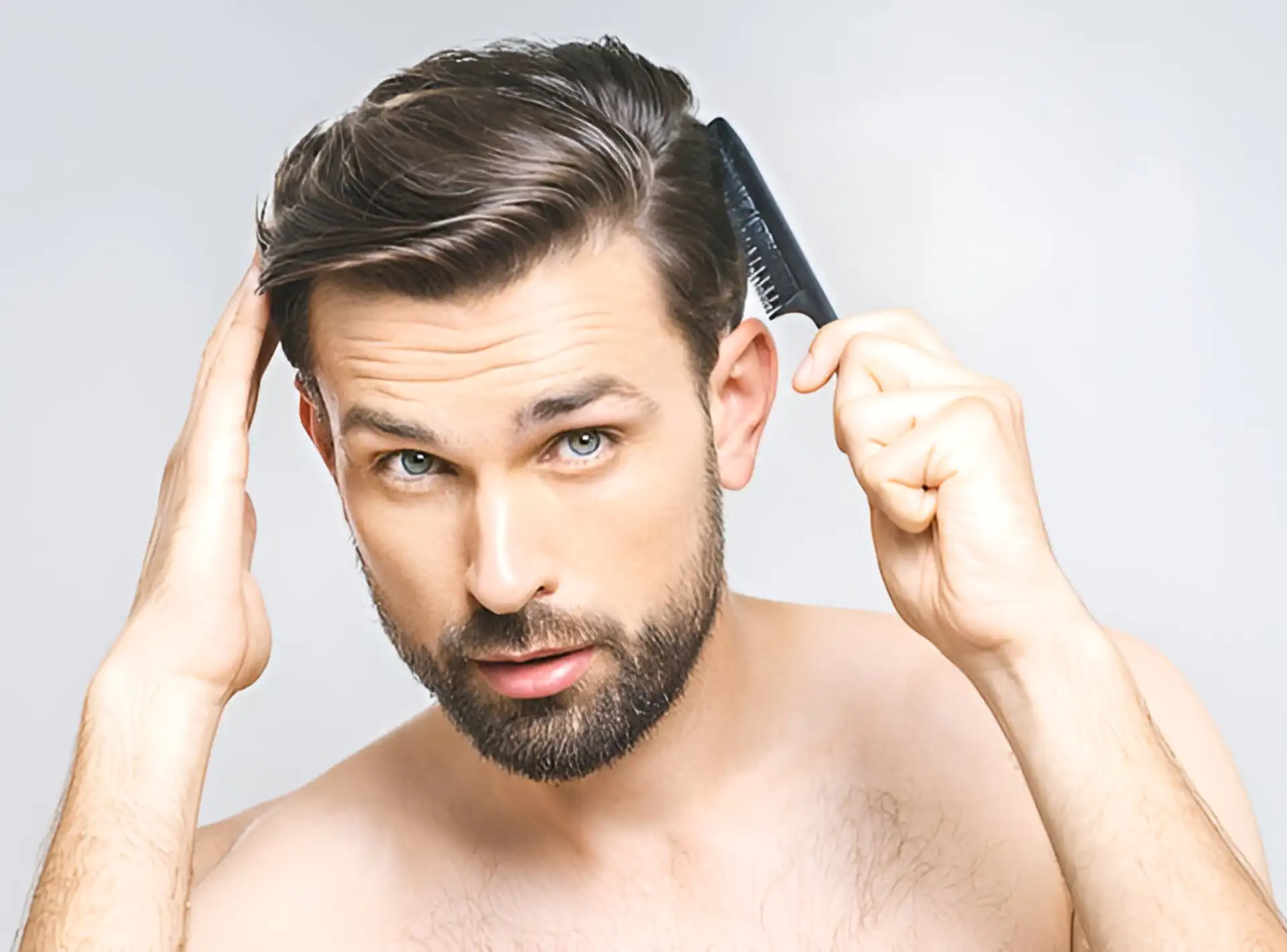 Male Hair Transplant - Perfect Doctors Clinic