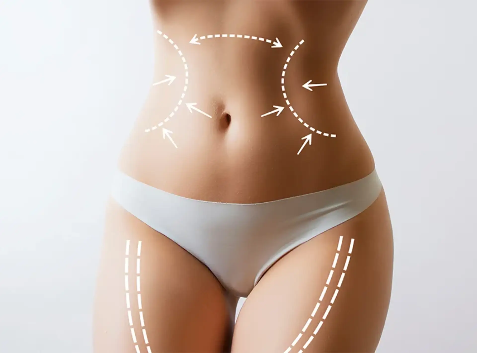 Liposuction: tell me all about it!
