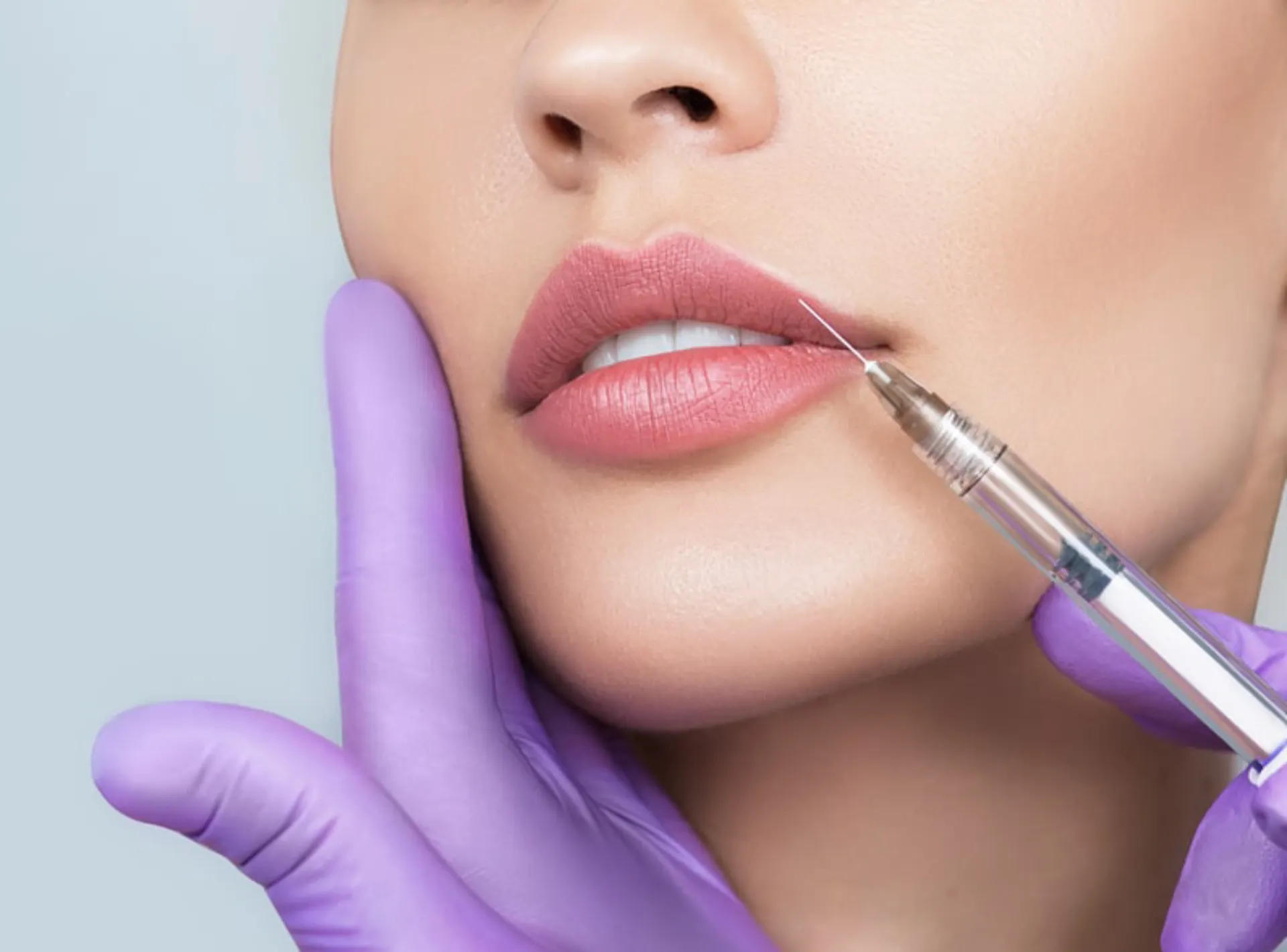 Lip Fillers in Dubai