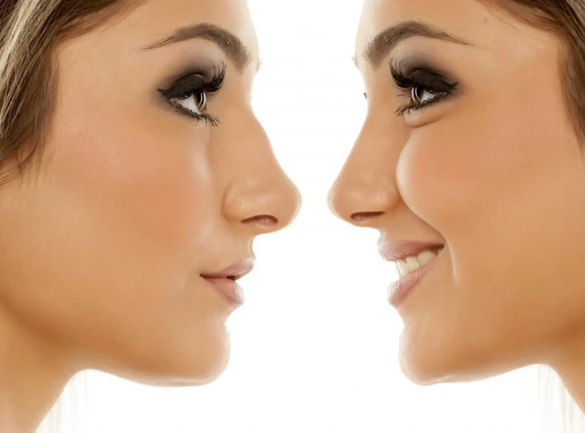 Rhinoplasty in Dubai
