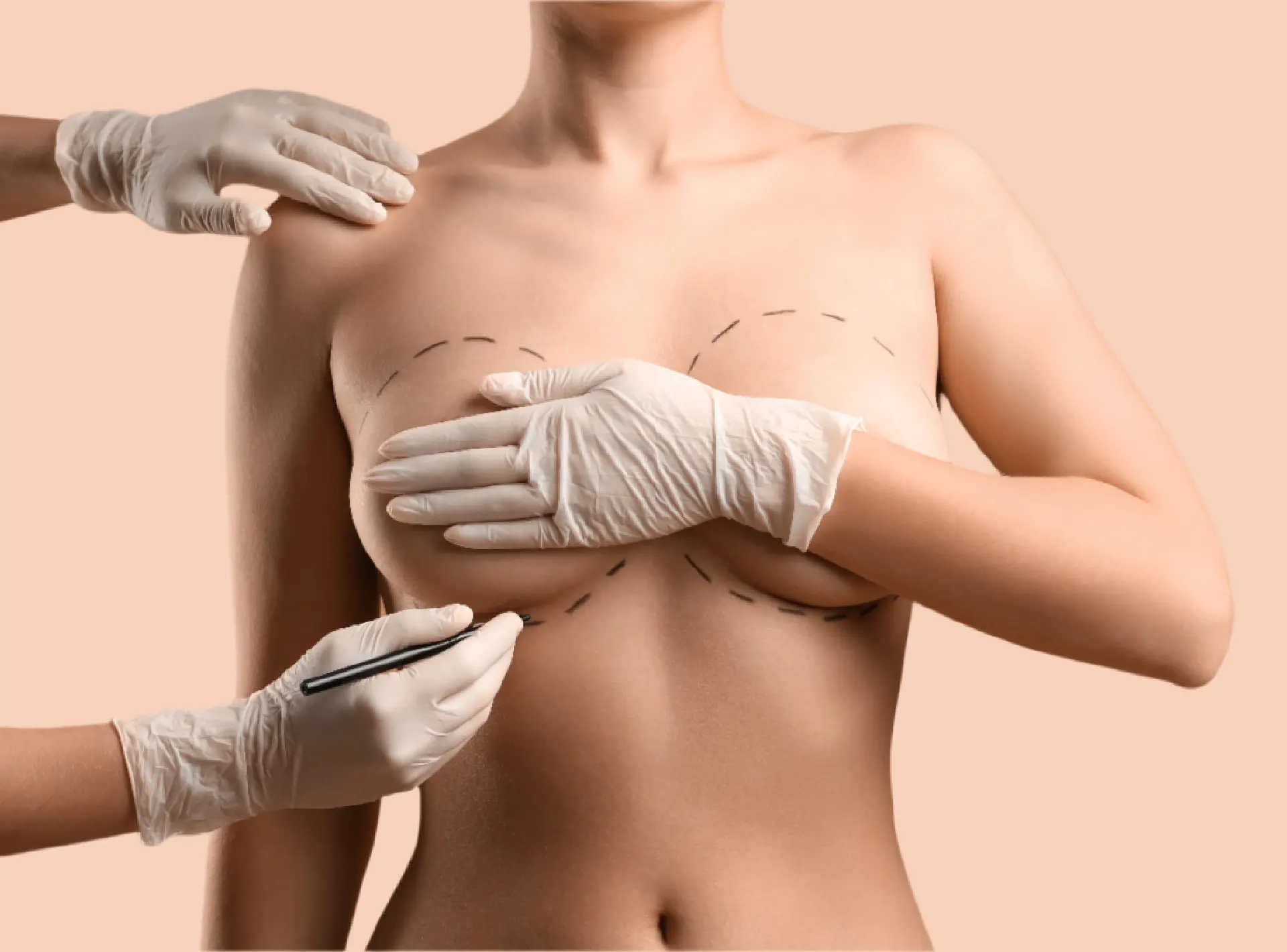 How long is the recovery for a breast augmentation?