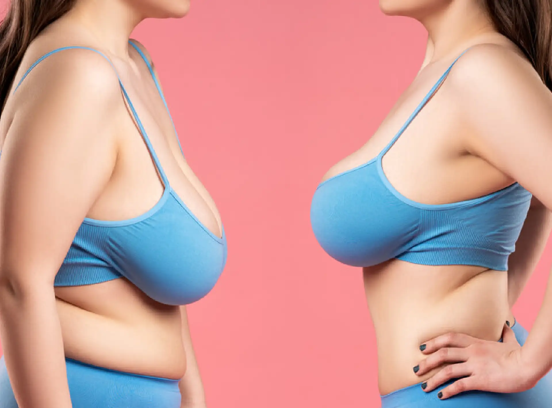 Breast augmentation vs breast lift - picking the right procedure for you