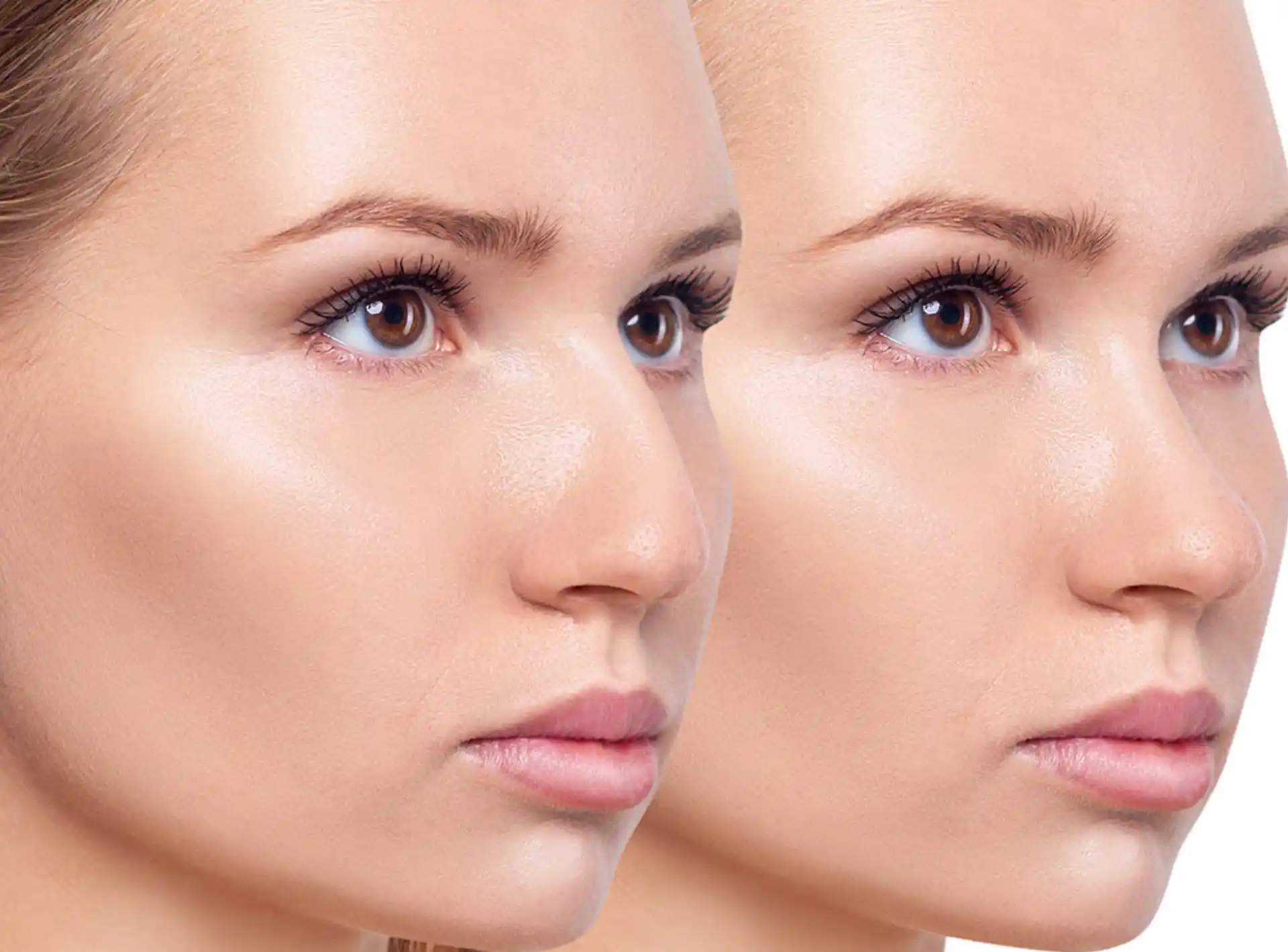 Can a non-surgical nose job fix a crooked nose?