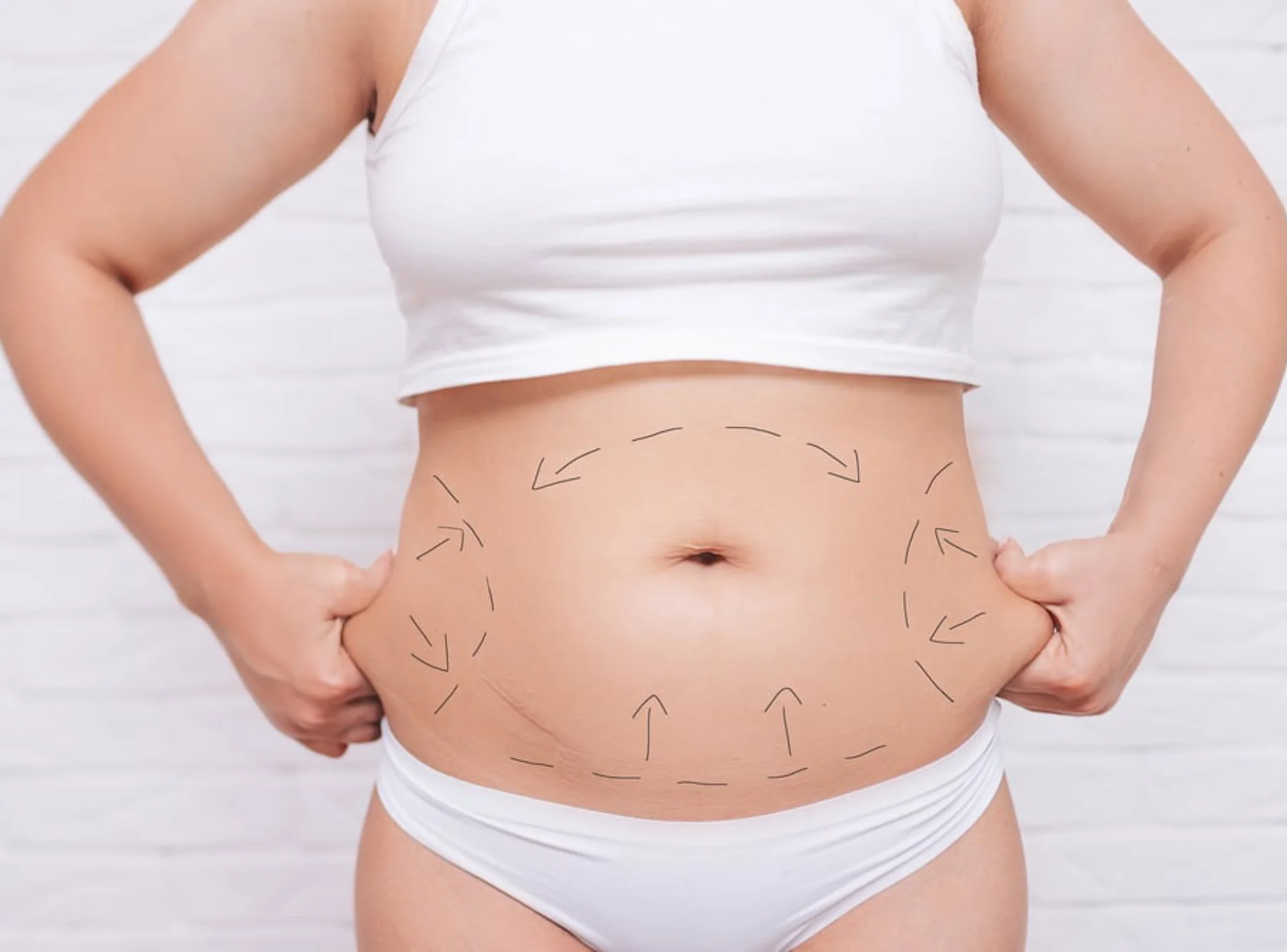 is Liposuction Worth It?