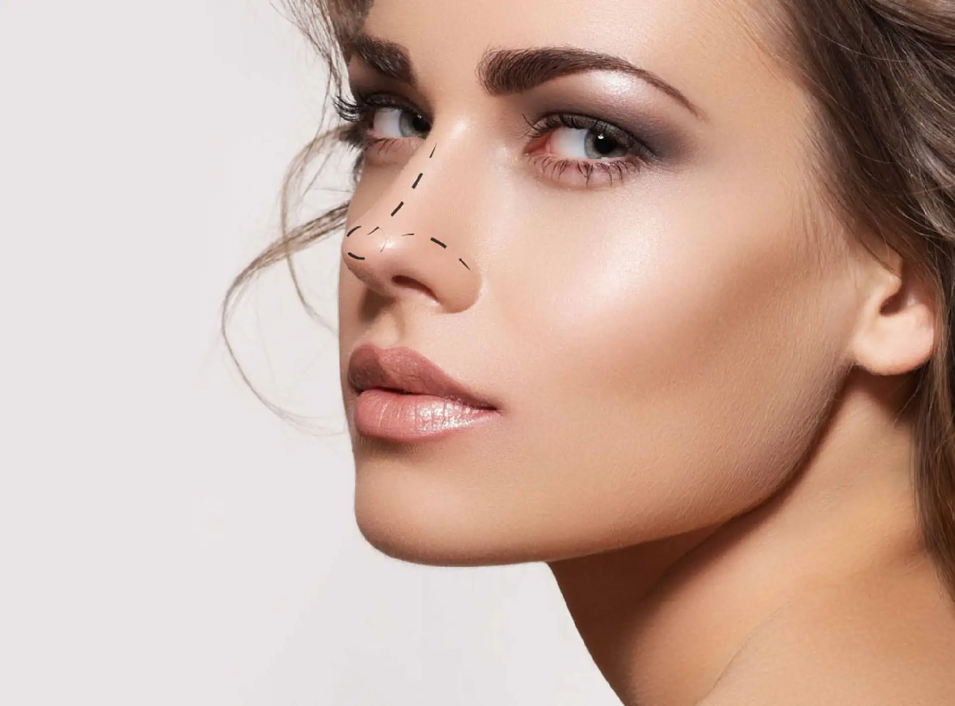 Open Vs Closed Rhinoplasty