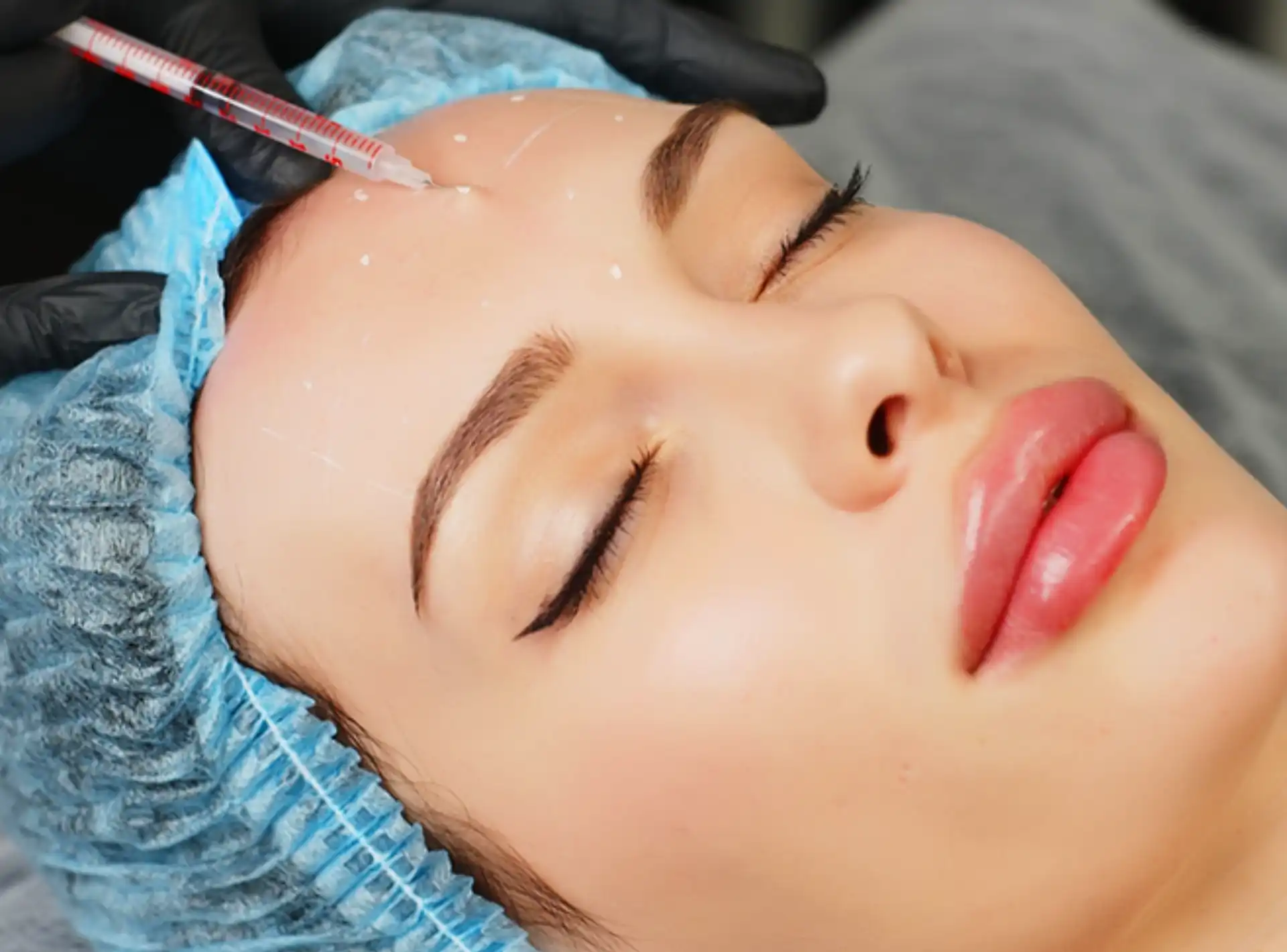 Rejuvenate Your Skin This Valentine Season with Botox Treatment