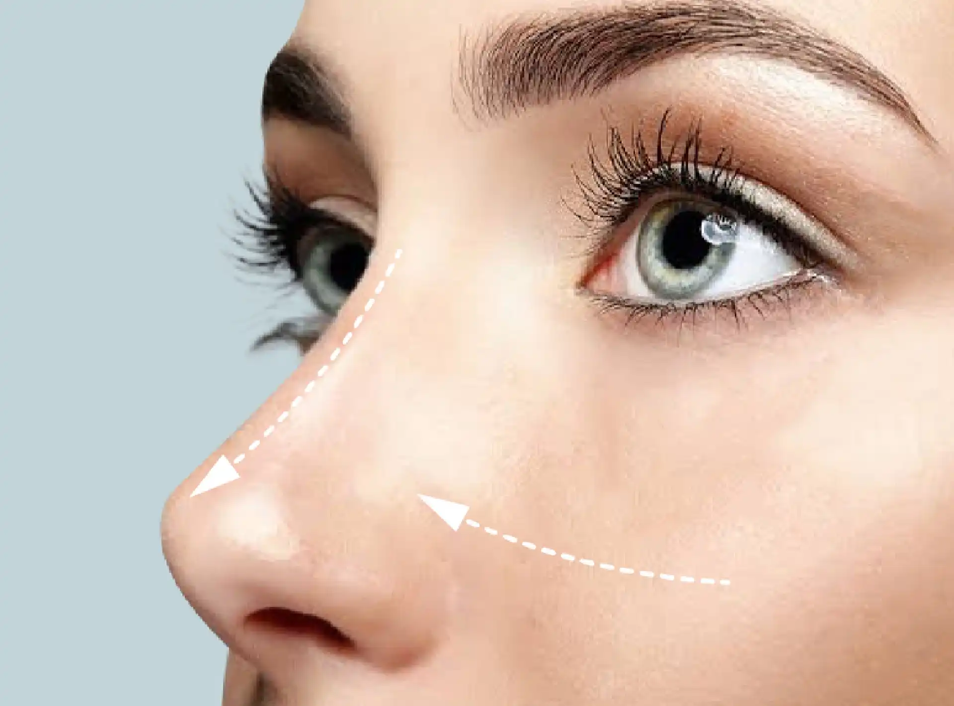 Voice May Change After Rhinoplasty