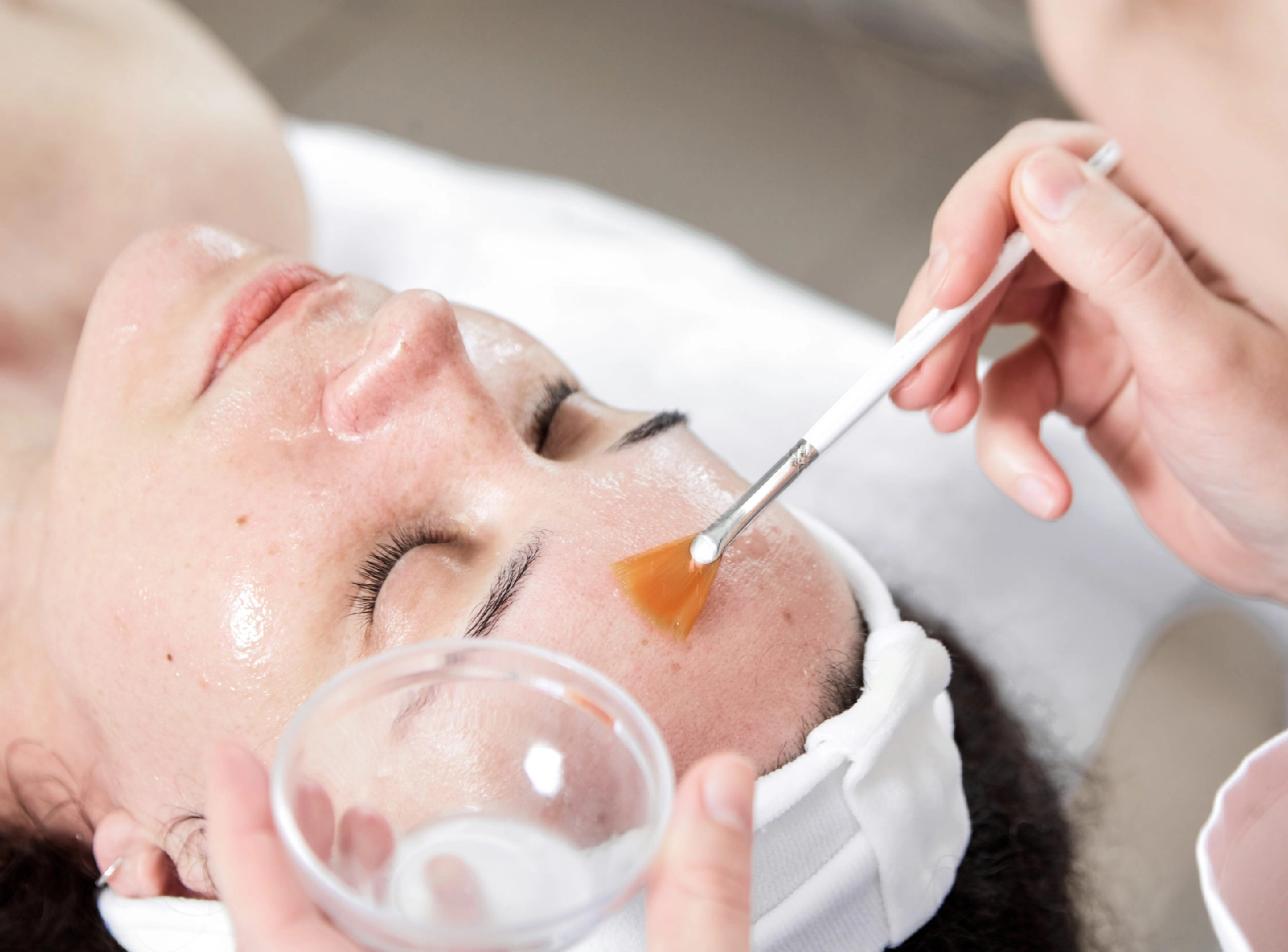 Everything You Need to Know About Chemical Peels