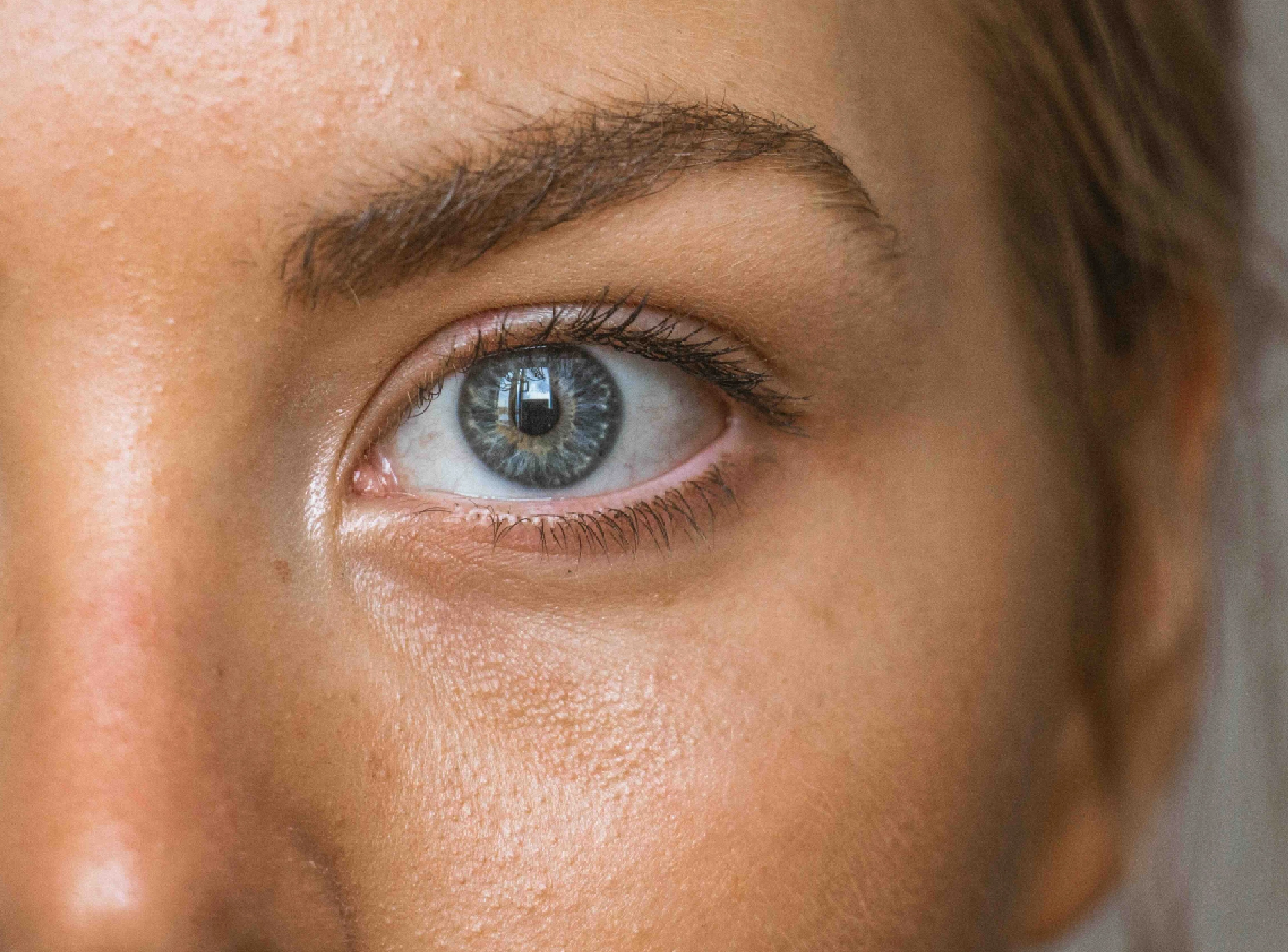 How Long Does Plexr Plasma Eye Lift Last in Dubai