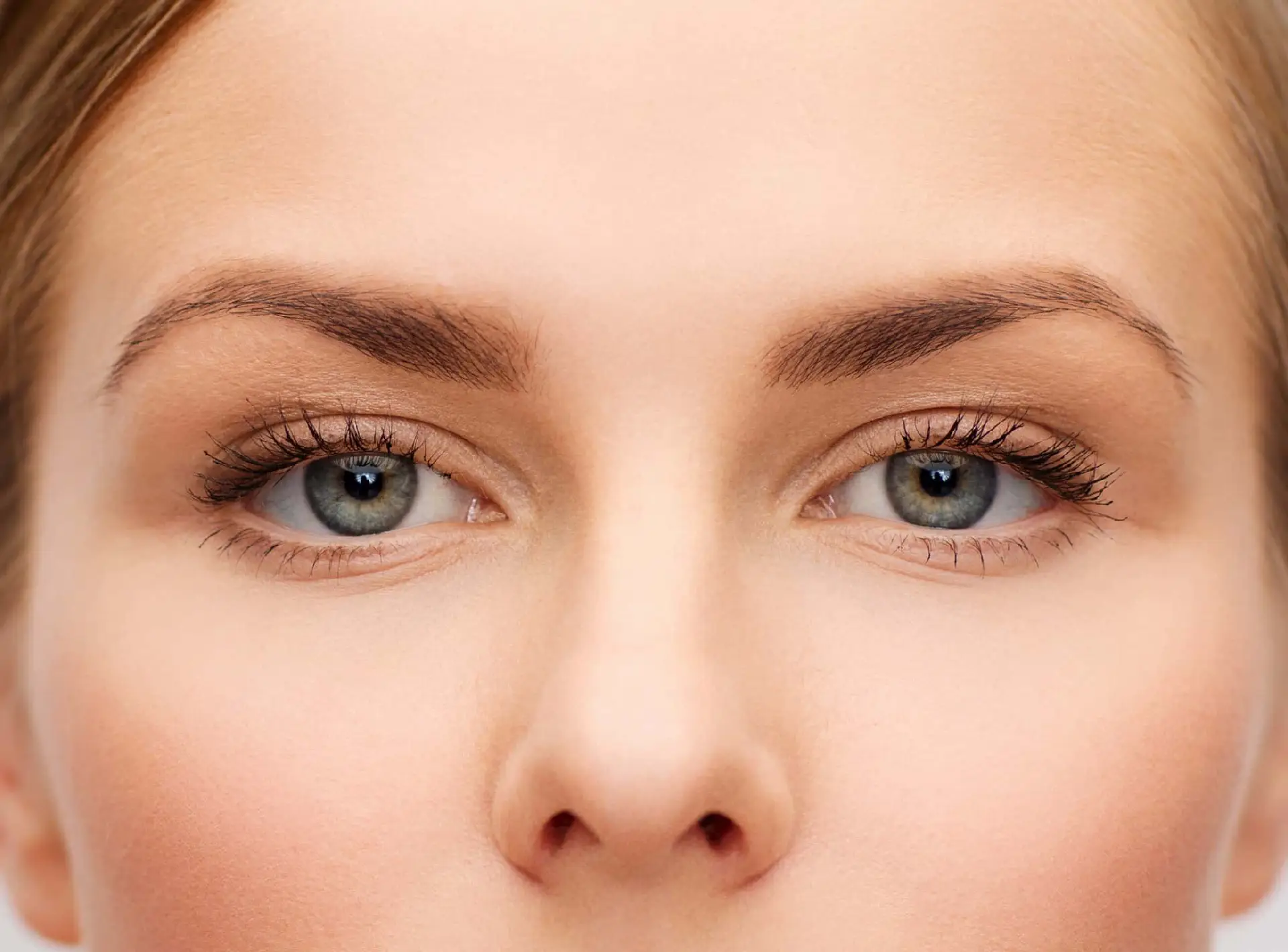 Lower Eyelid Blepharoplasty In Dubai – Fat Transposition Method