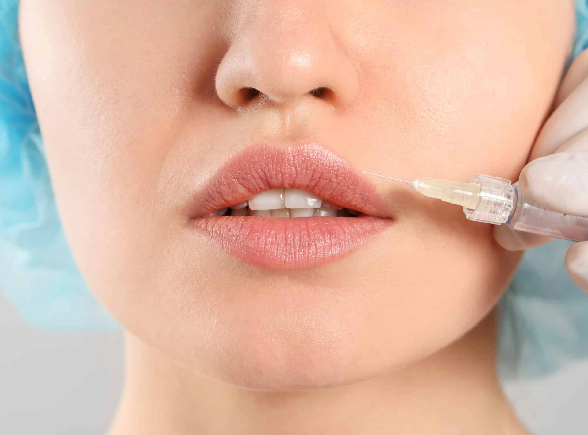 Juvederm Vs Restylane