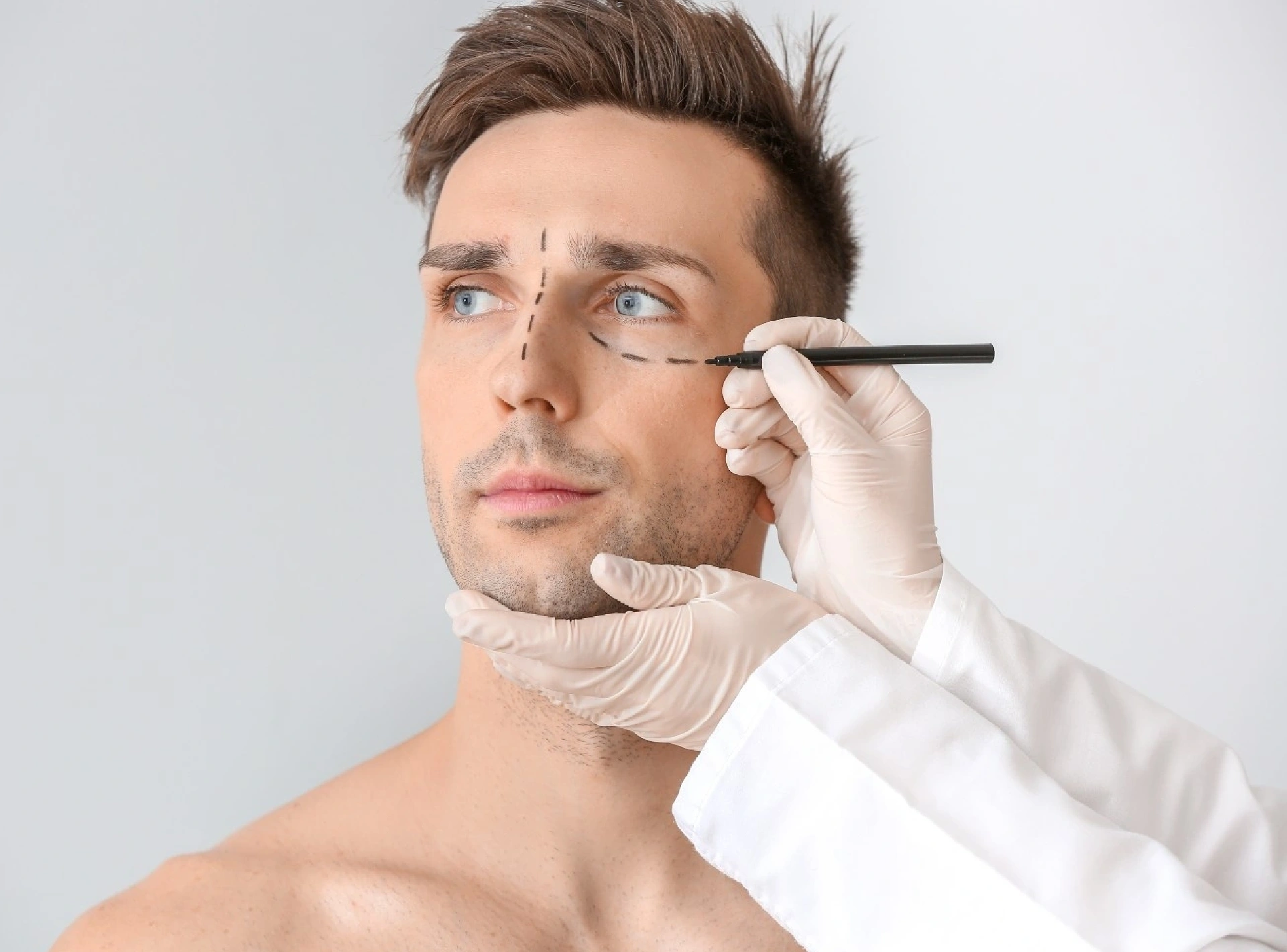Lower Blepharoplasty with Fat Transfer