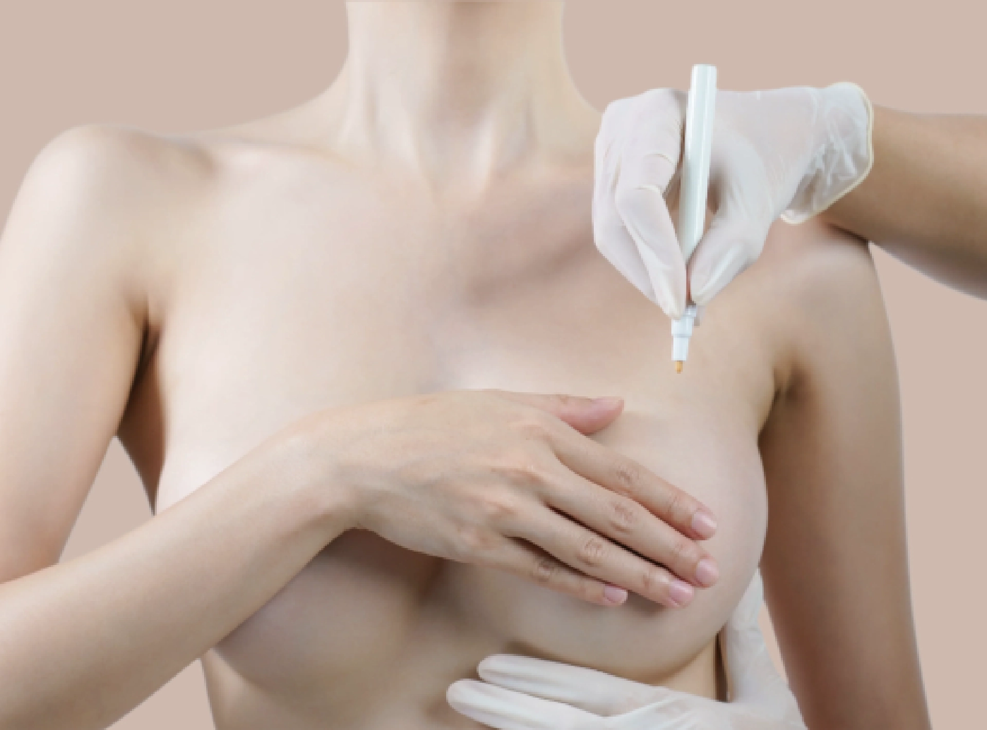 Modern Techniques for Breast Reduction