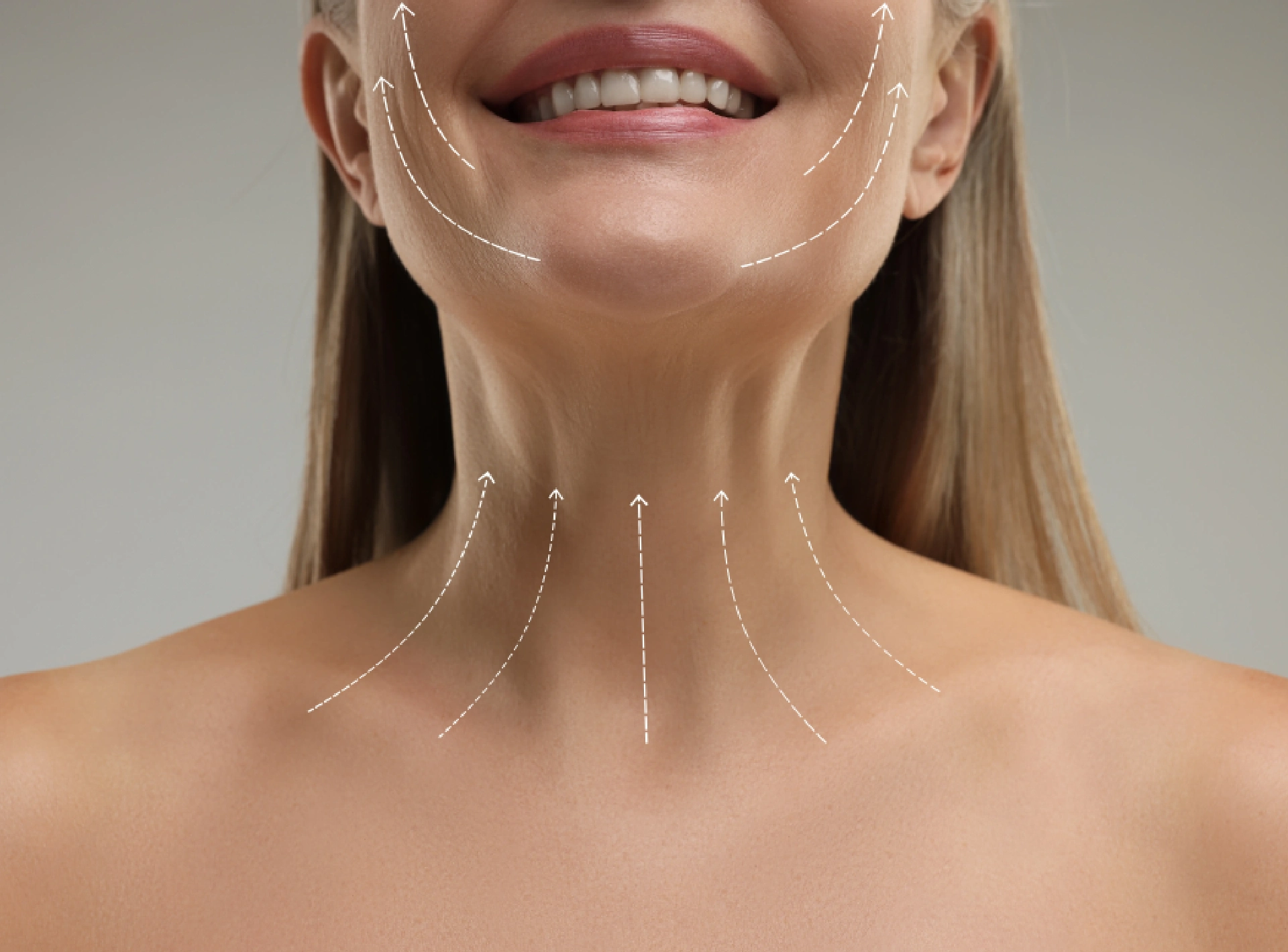 Benefits of a Neck Lift in Dubai