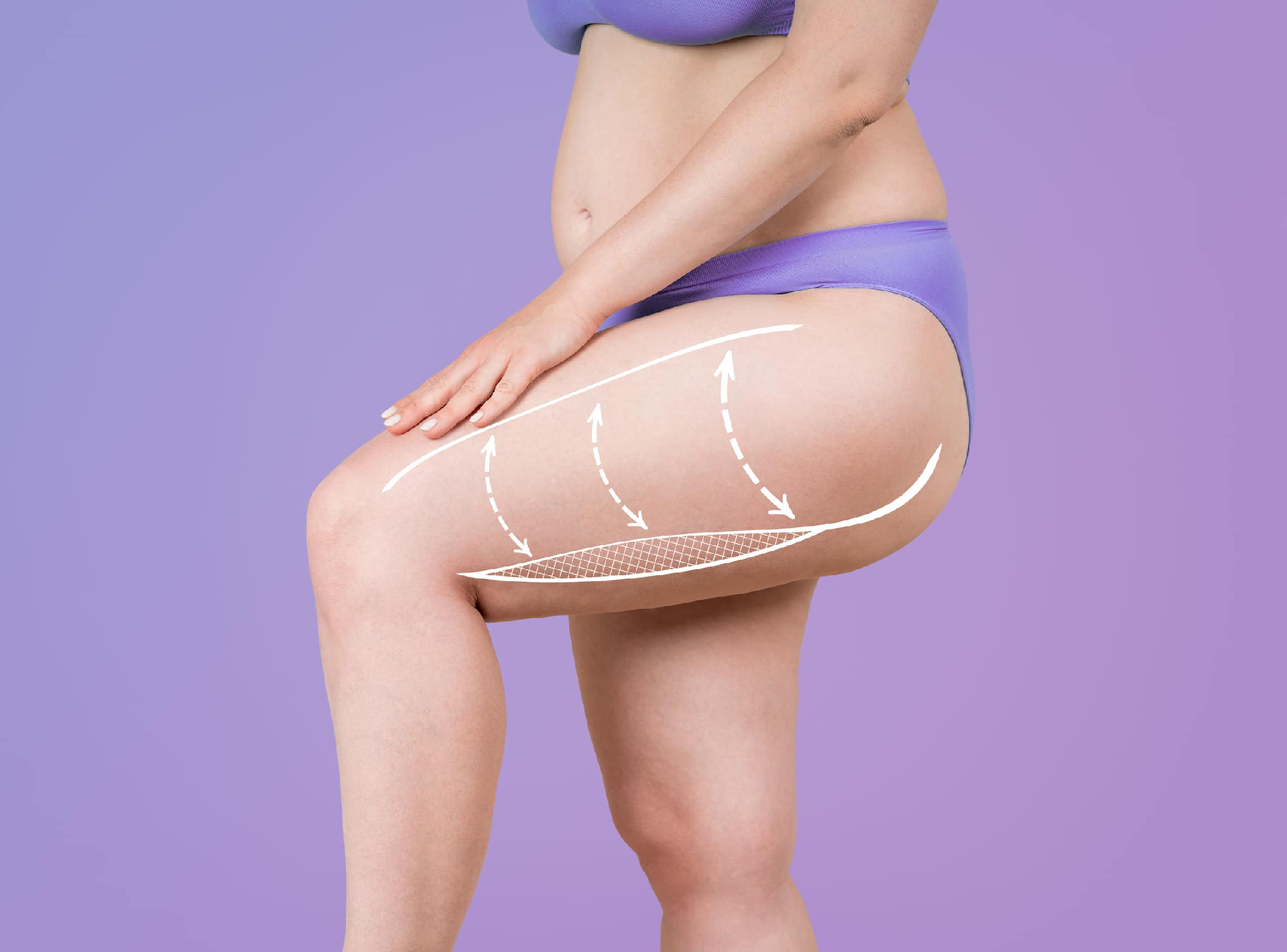 Growing Popularity of Arm and Thigh Lifts in Aesthetic Surgery