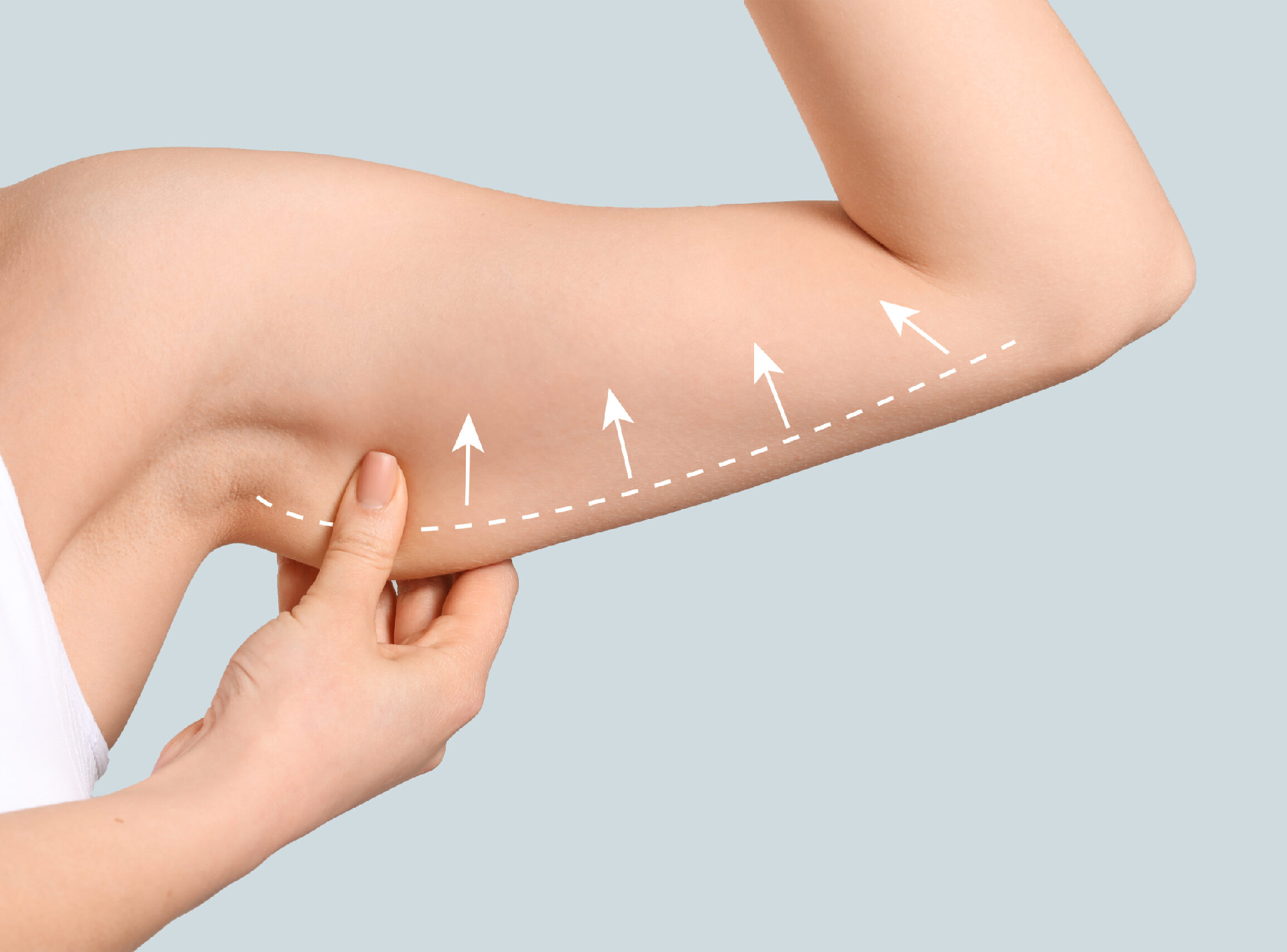 an Arm Lift and Much More from a Terrific Plastic Surgeon