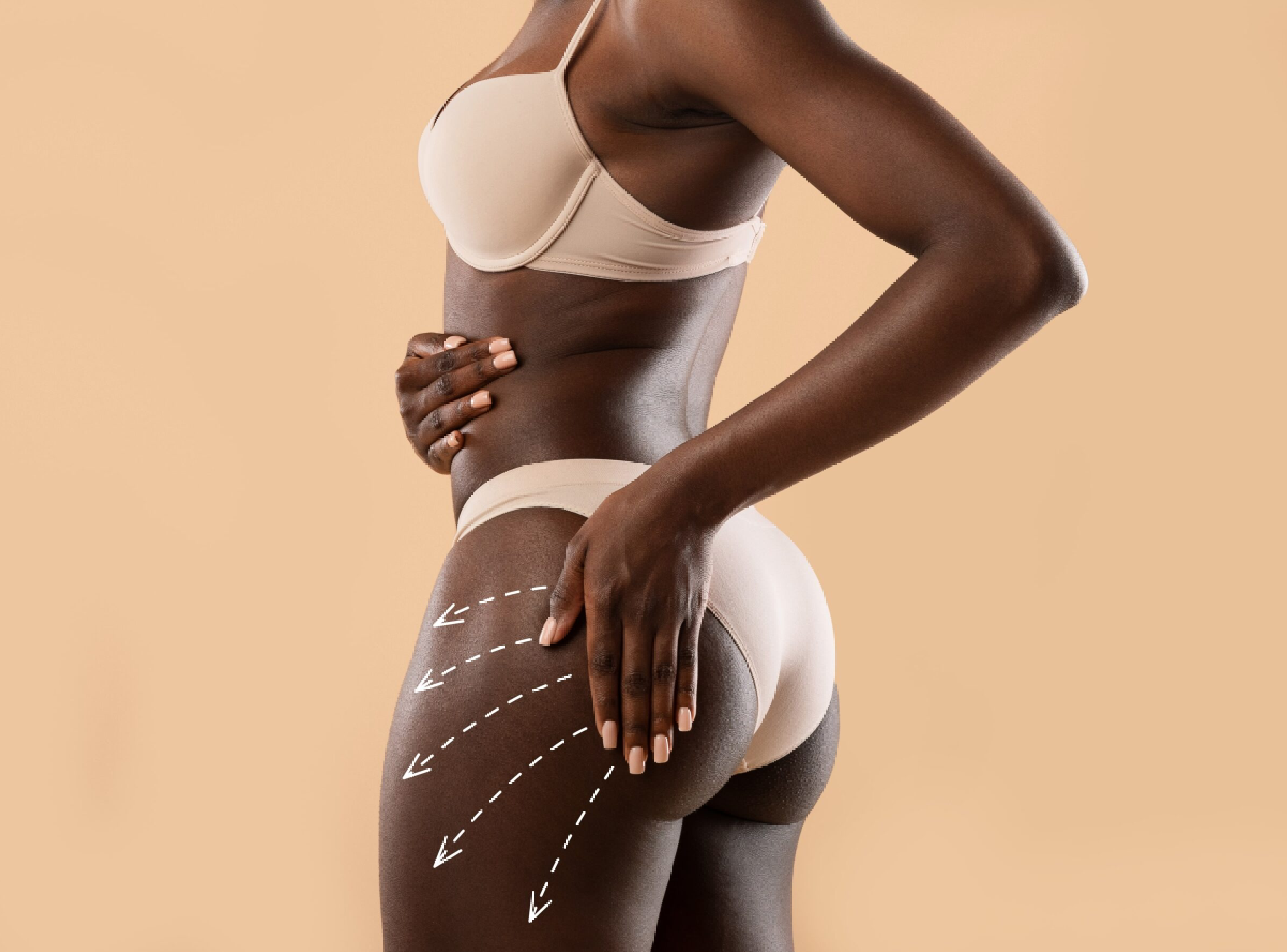 Brazilian Butt Lift Leads to a Stunning Posterior