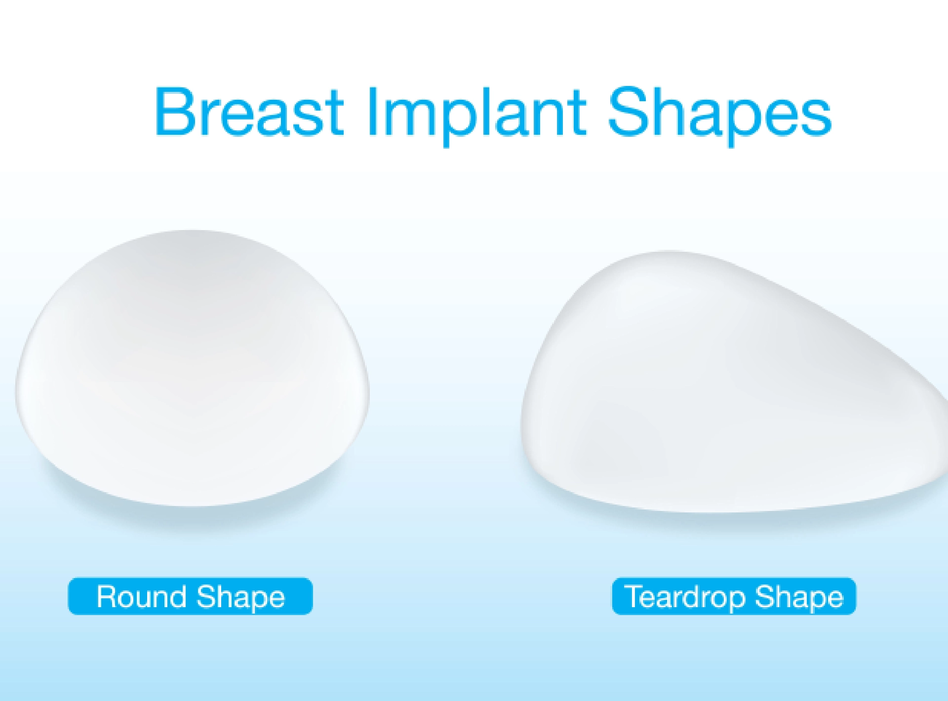Which Breast Implant Shape is Most Attractive?