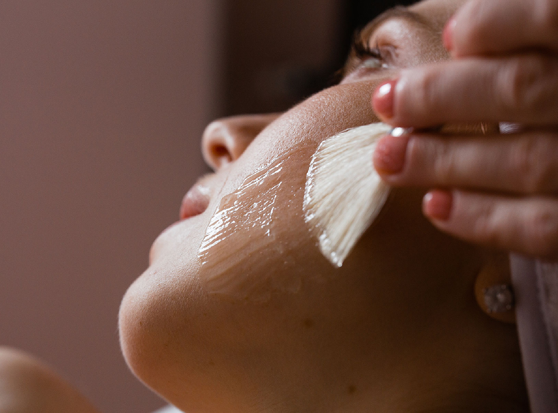 is Chemical Peel Good for Skin?