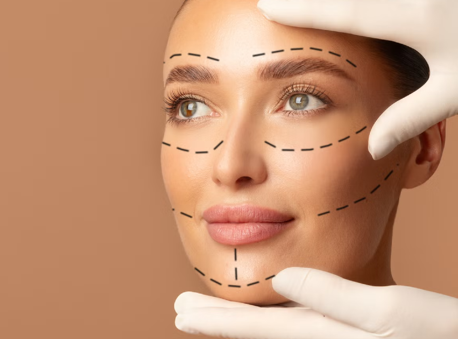Deep Plane Facelift Technique in Dubai and Its Advantages