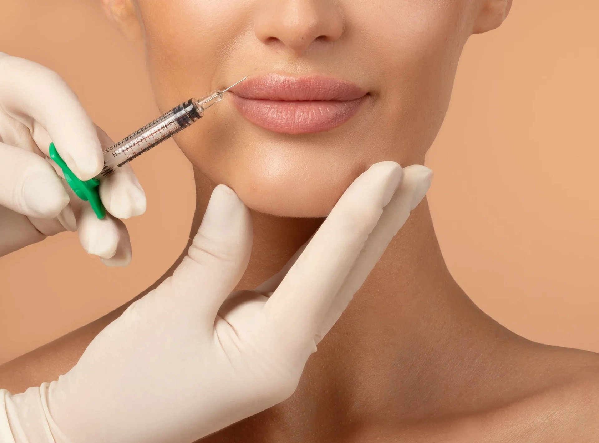 What You Should Know Before You Have a Lip Filler
