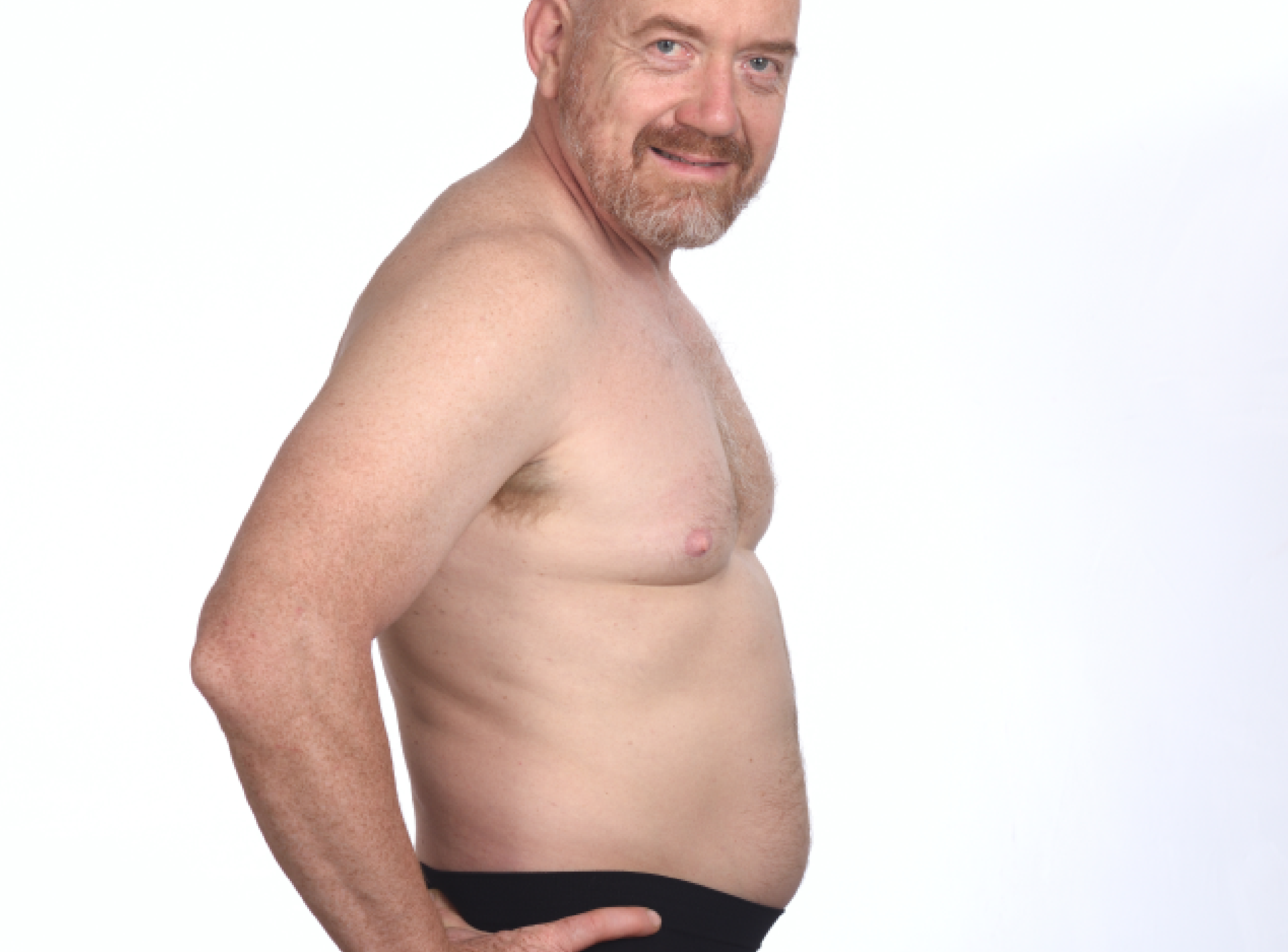 Men Benefit from Full Body Liposuction