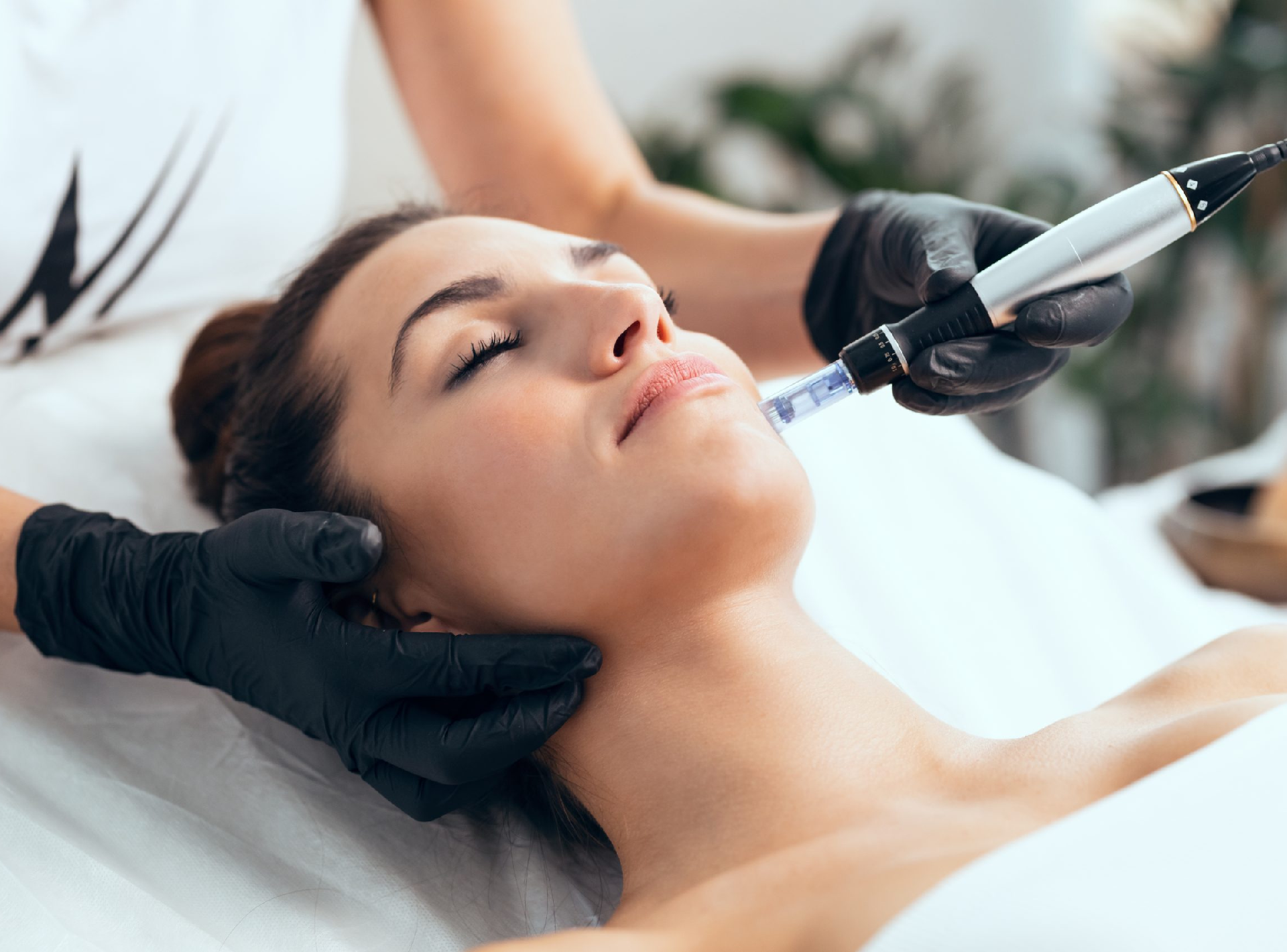 How Long To See Microneedling Results | Perfect Doctors Clinic