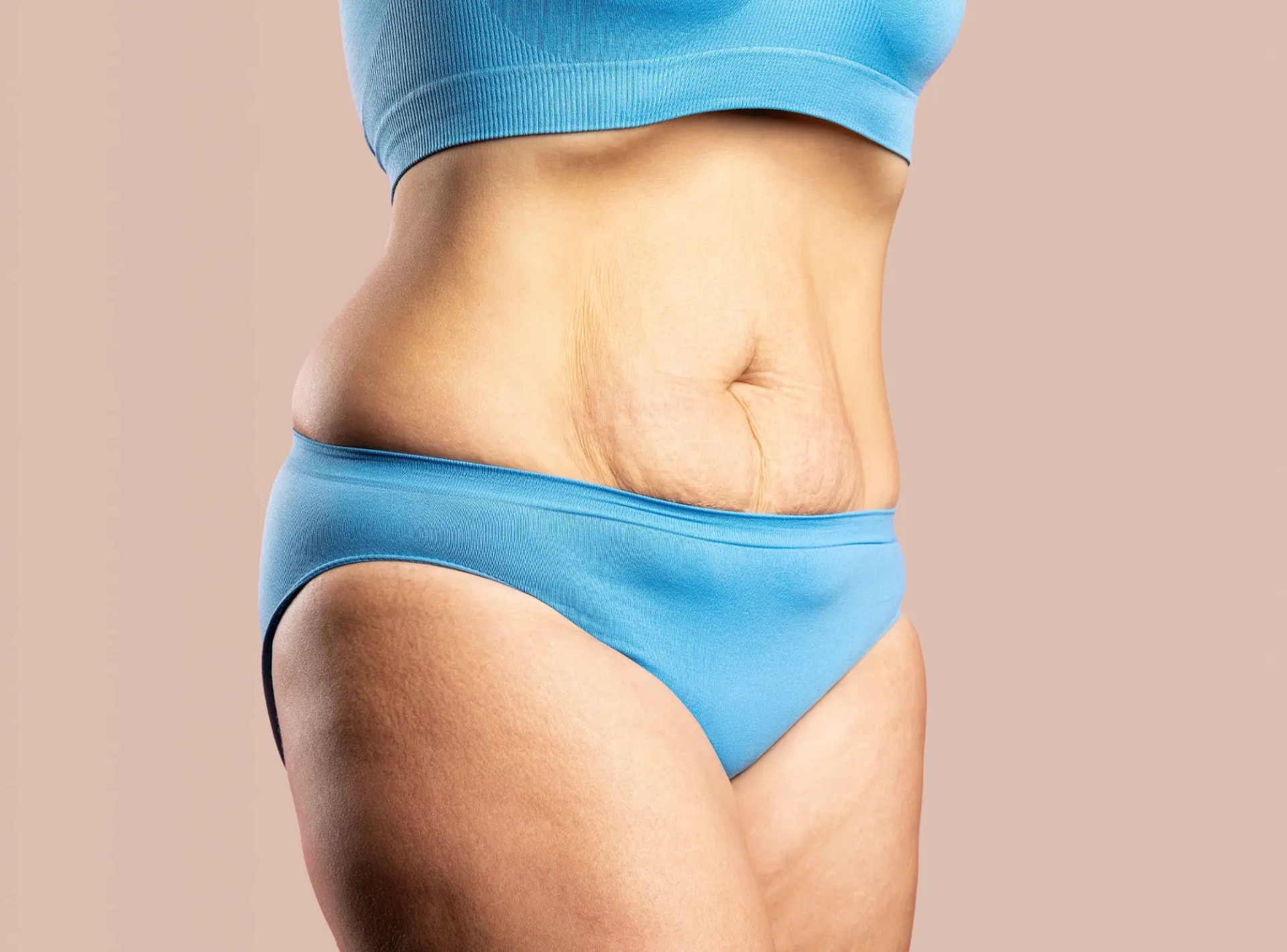 How to Lose Excess Skin After Weight Loss