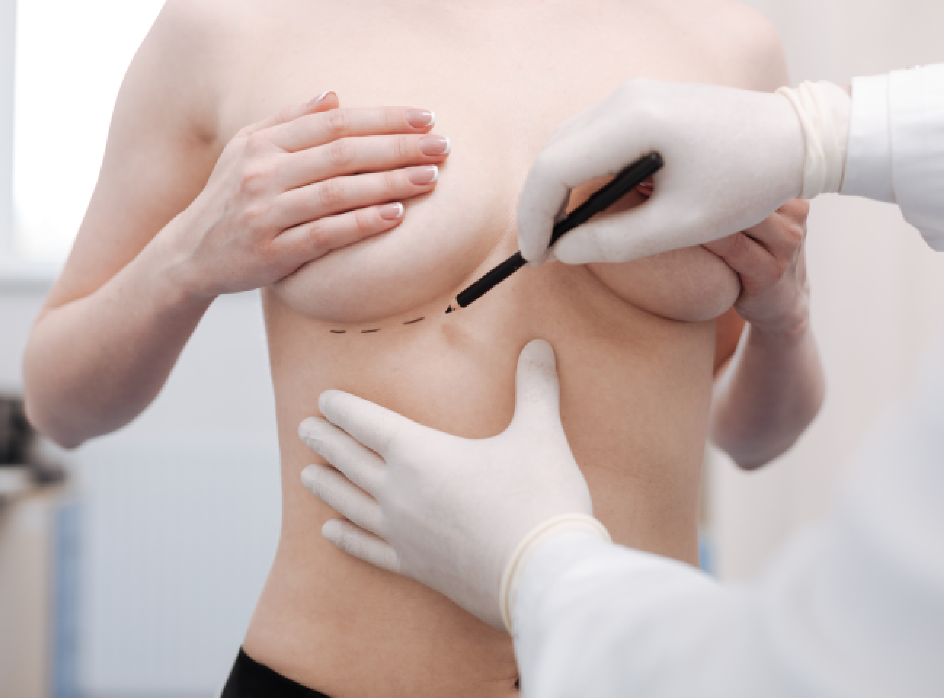What Are the Treatments and Procedures for Breast Lifts?