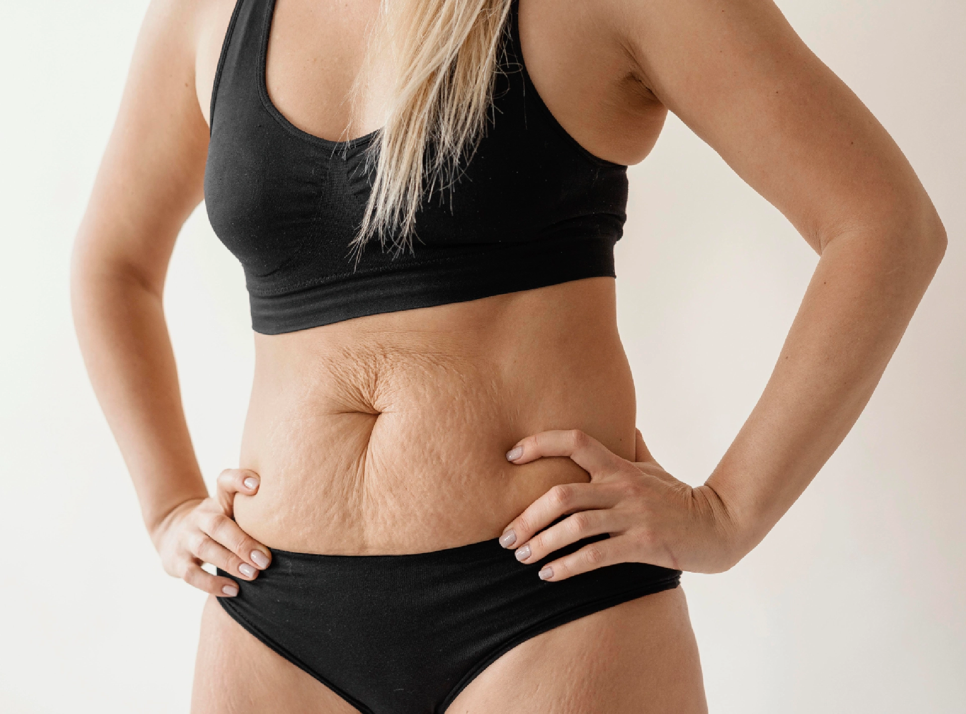 5 Superb Tips to Get the Best Results from a Tummy Tuck Surgery