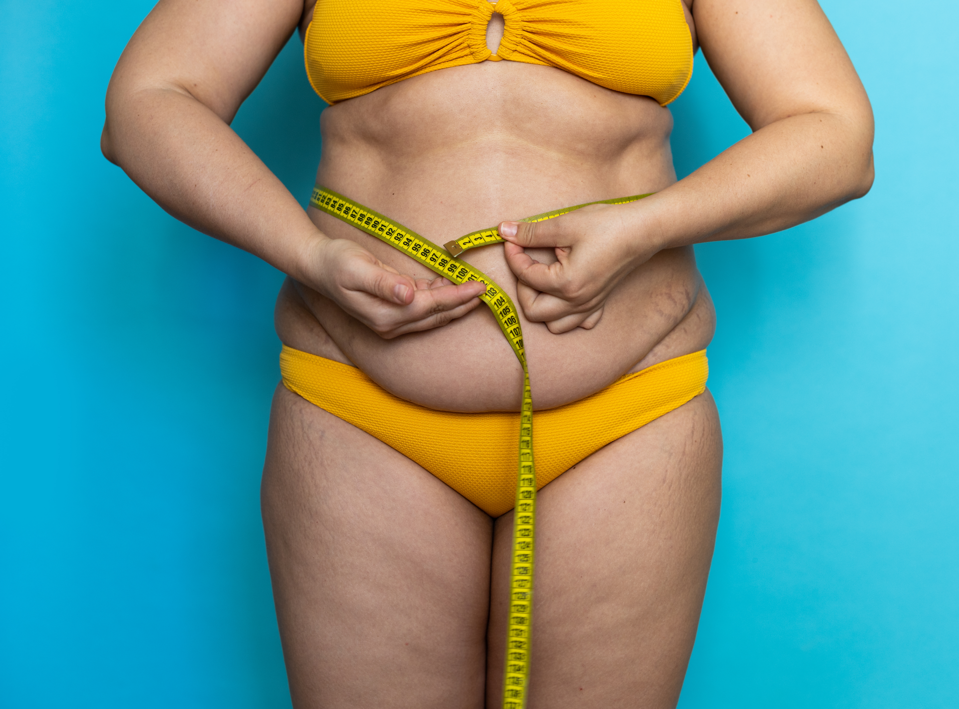 Weight You Lose Through Bariatric Surgery