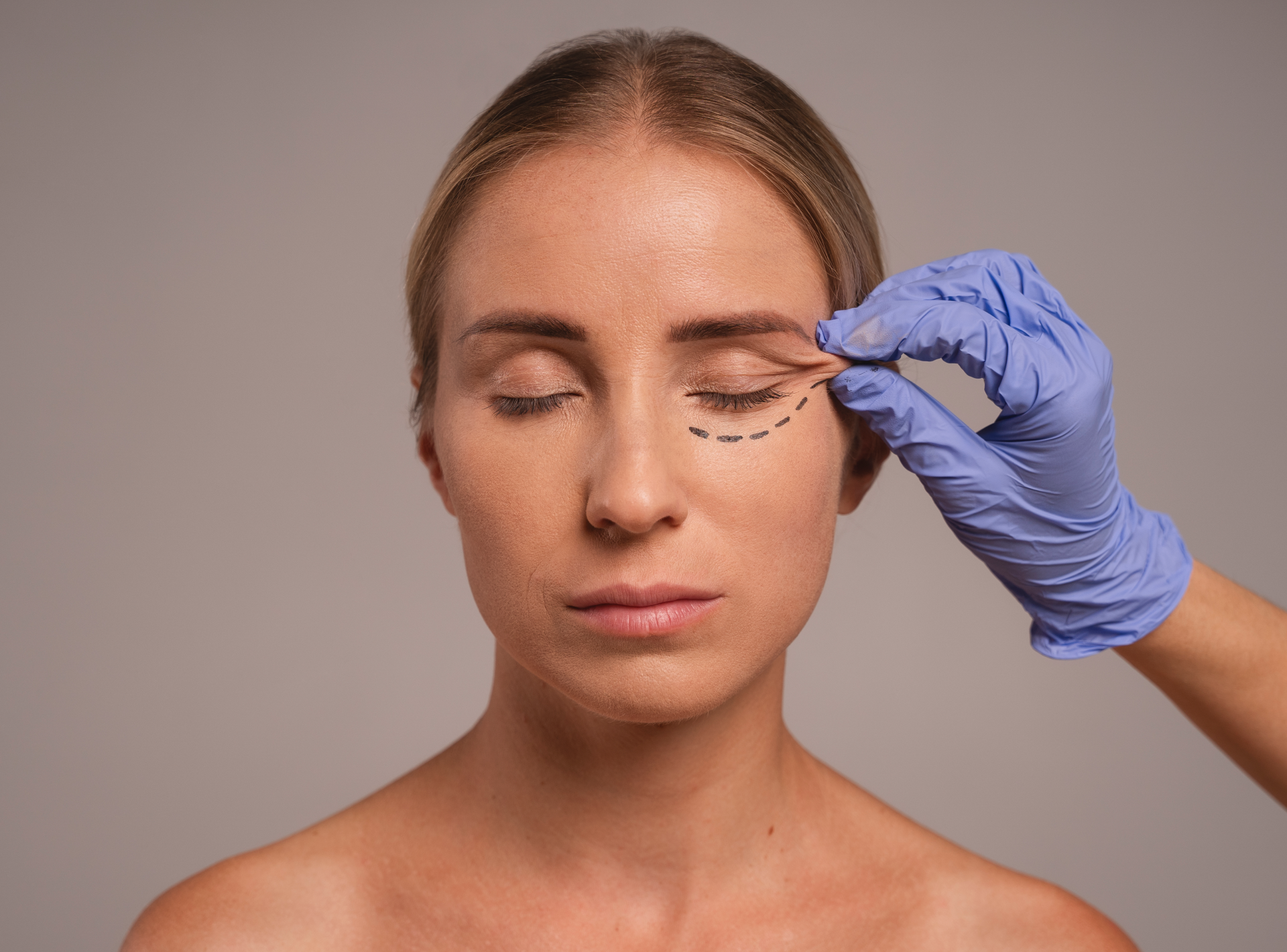 5 Things You Should Know Before You Decide to Have Eyelid Surgery