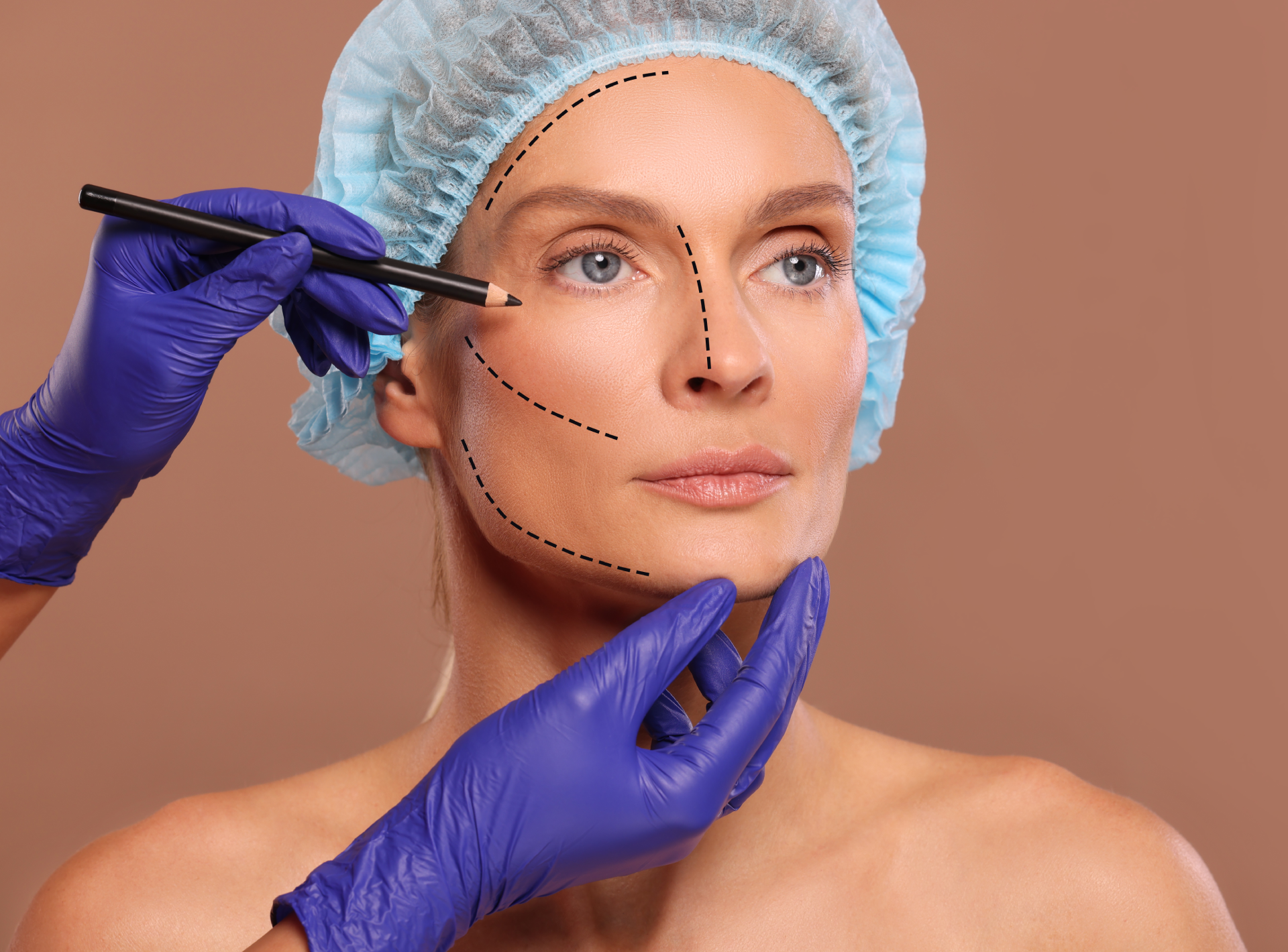 Smas Vs. Deep Plane: Which Facelift is Right for You?