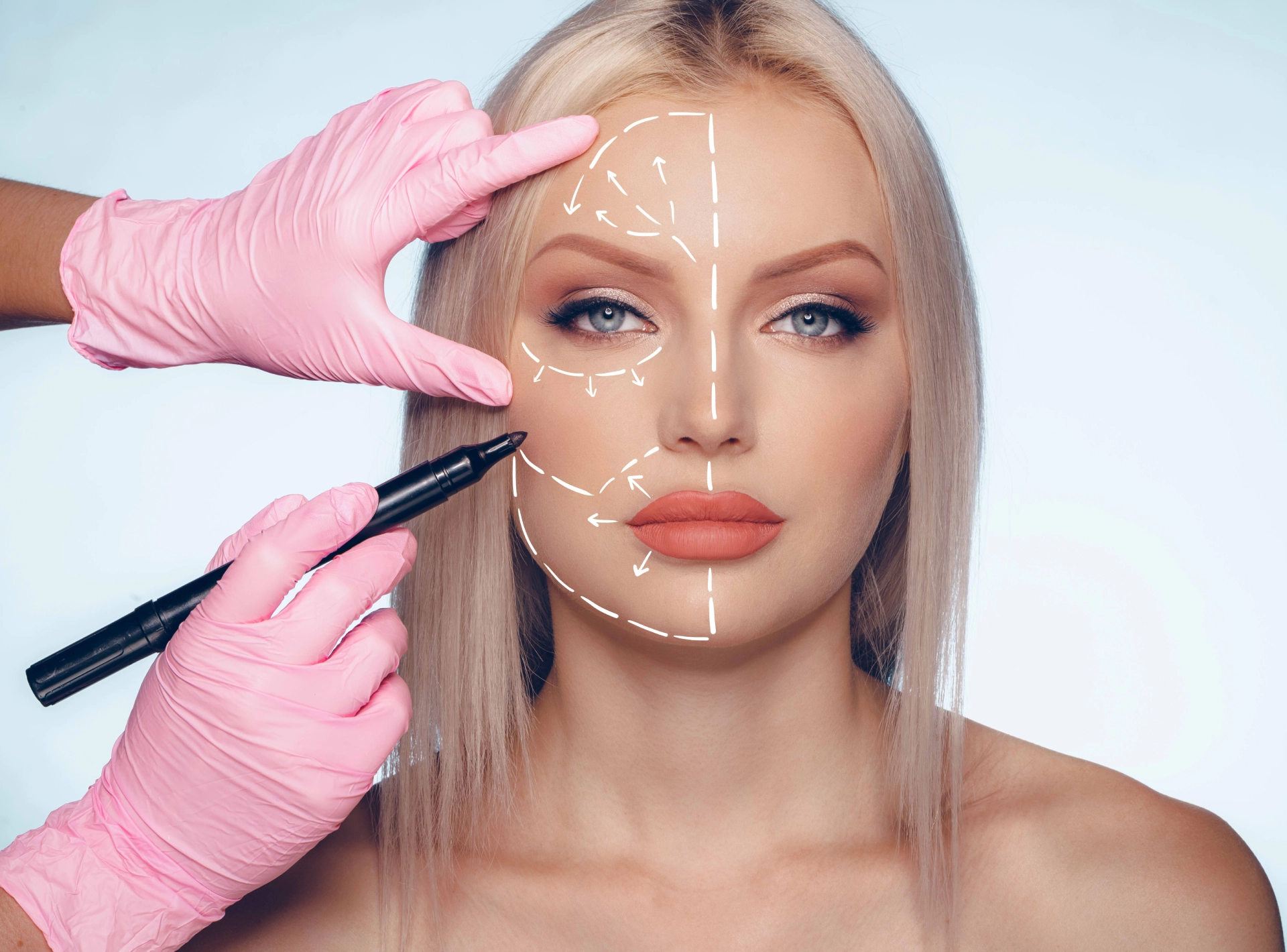 Am I Too Young for a Facelift?
