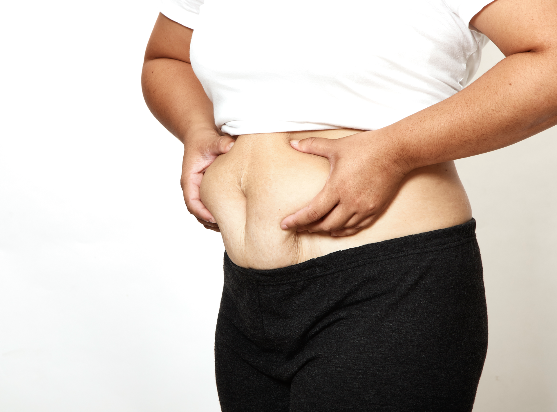 What is the Difference Between Liposuction and a Tummy Tuck