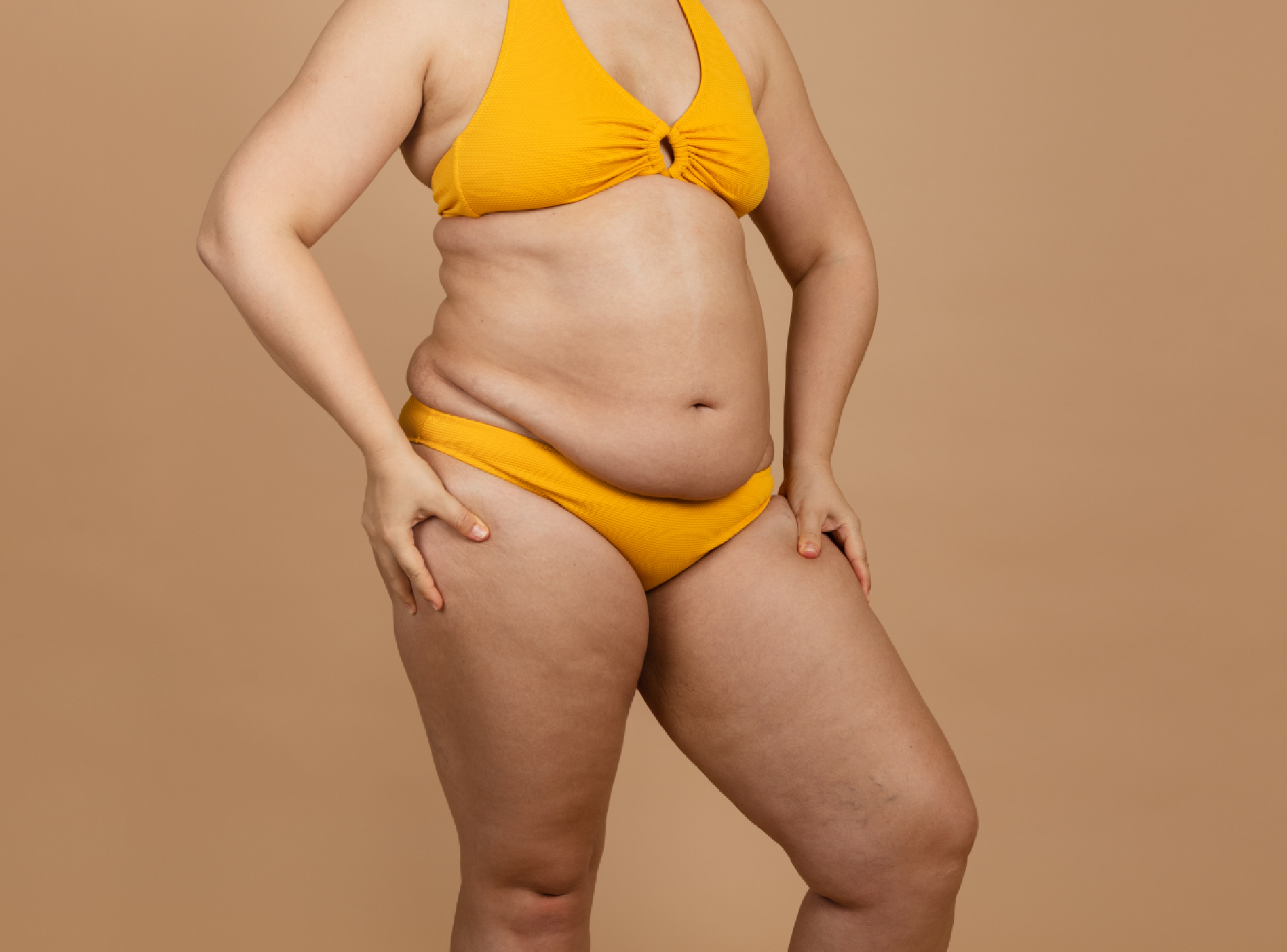 Difference Between Liposuction & Liposculpture?