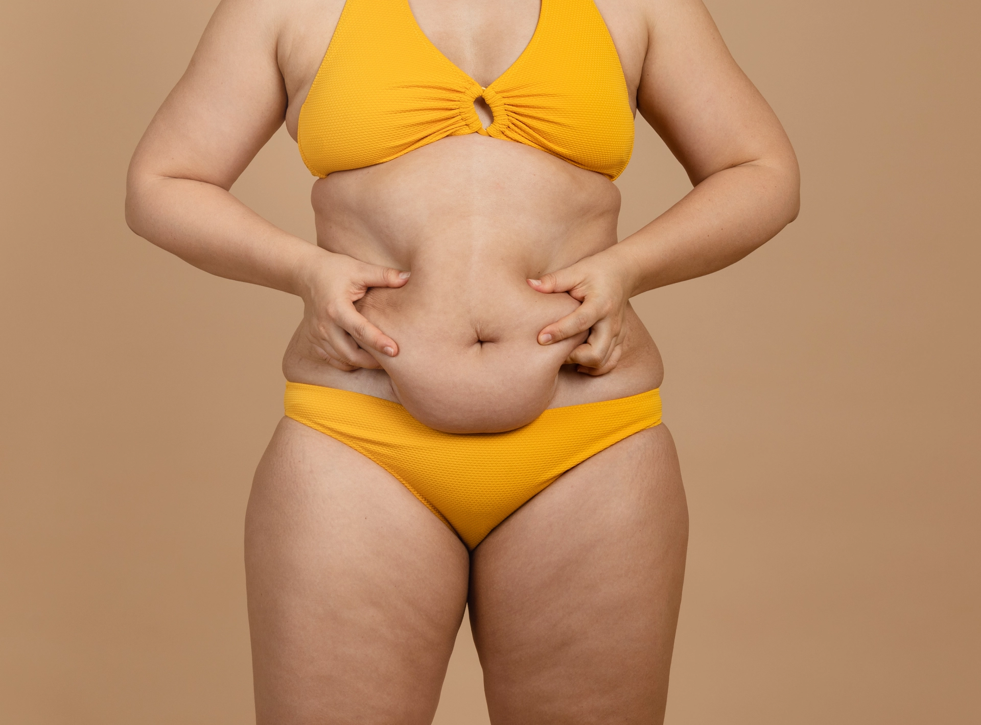 What Are the Differences Between a Liposuction and Tummy Tuck?
