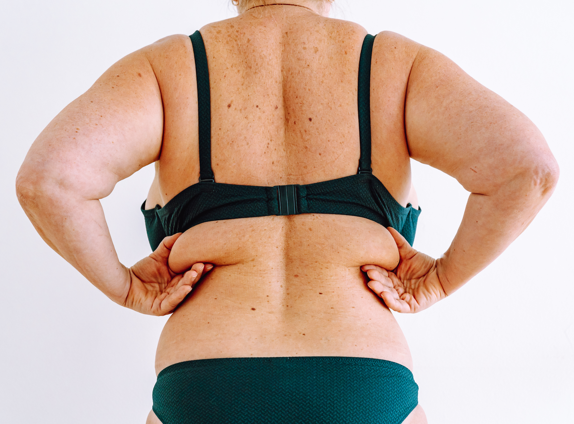 Get Your Body and Your Confidence Back with a Mommy Makeover!