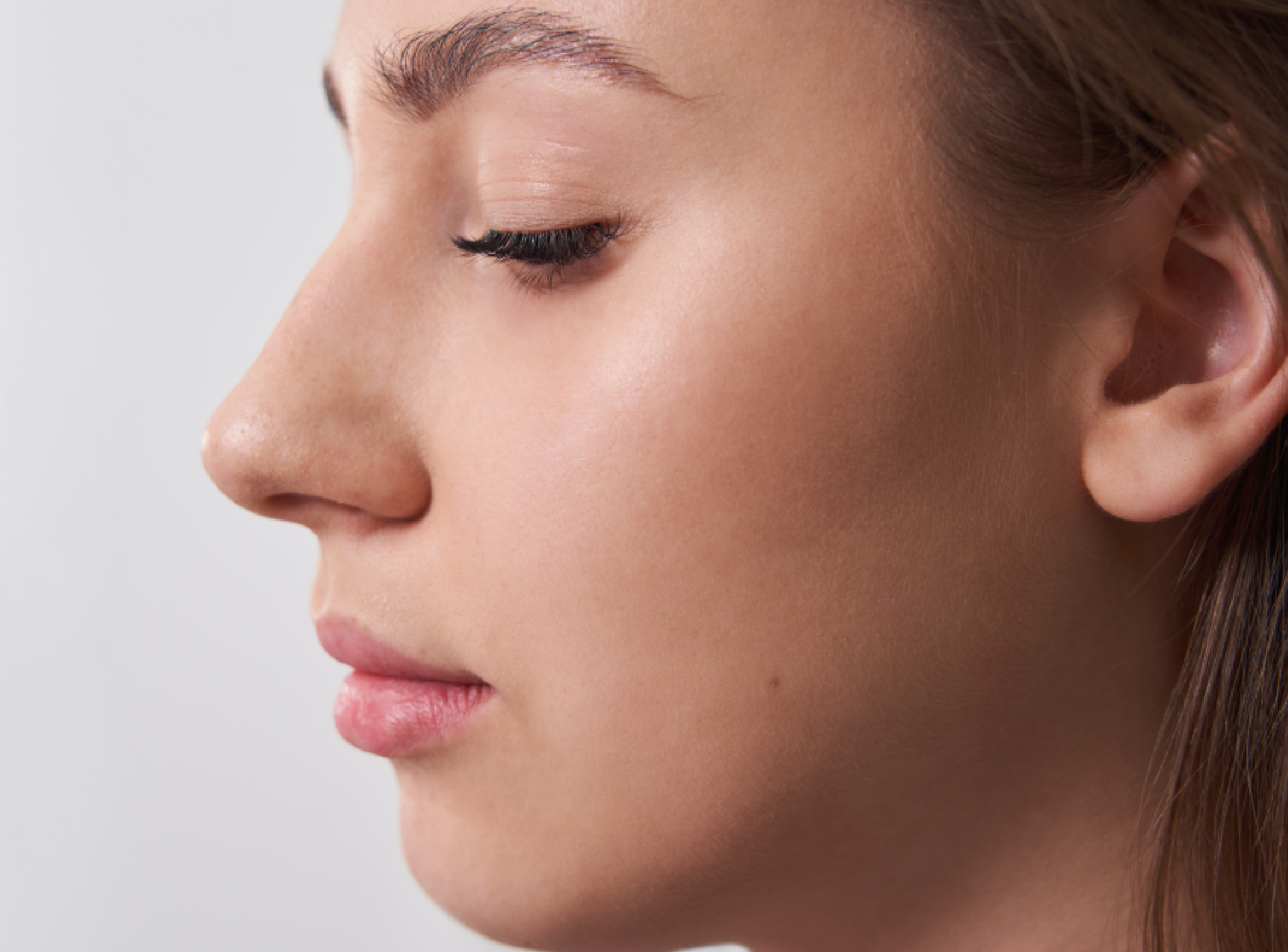 Remove the Hump in Your Nose