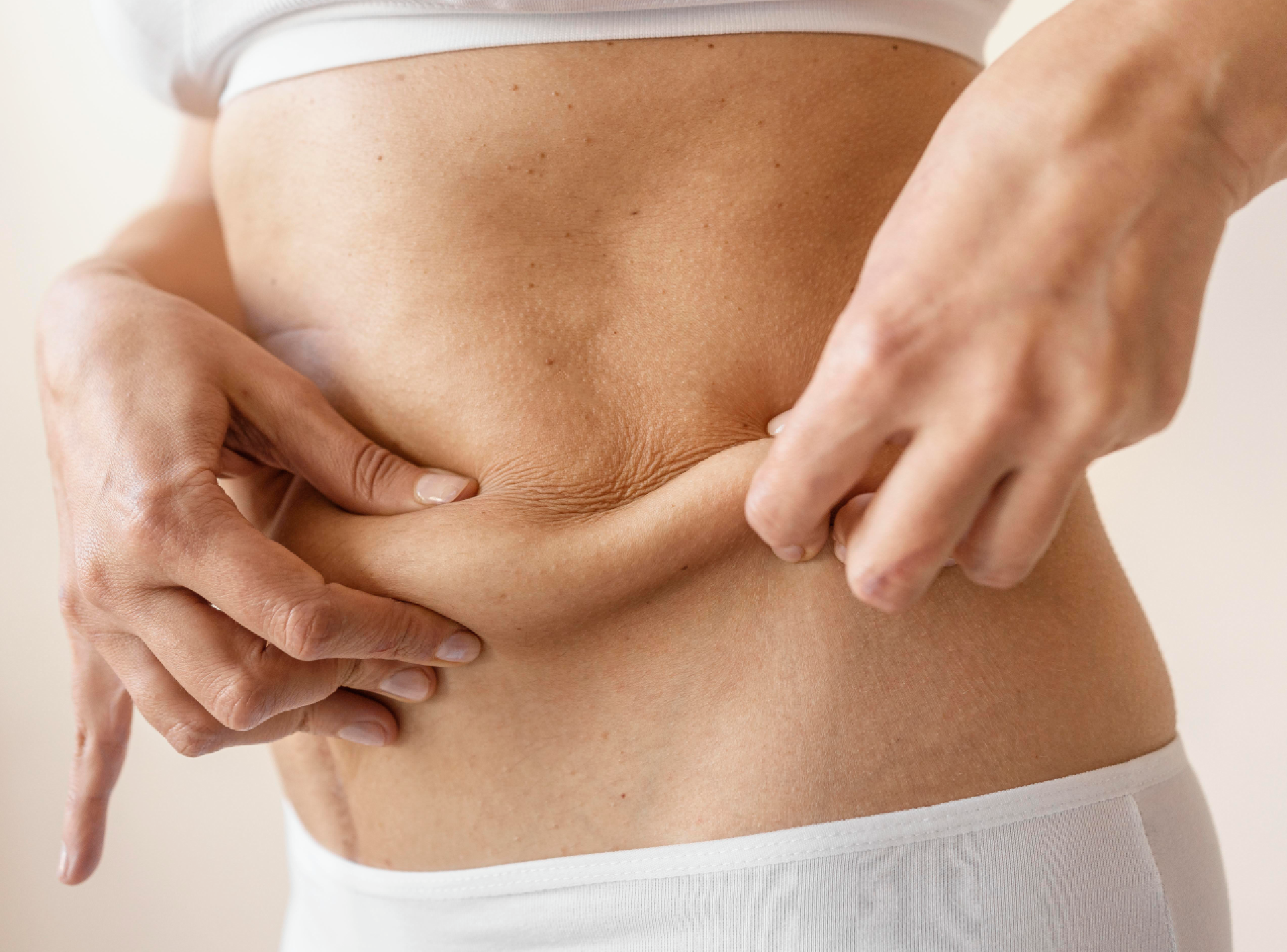 Best Lift Surgery Options After Ozempic: Tummy Tuck, Arm Lift, and More
