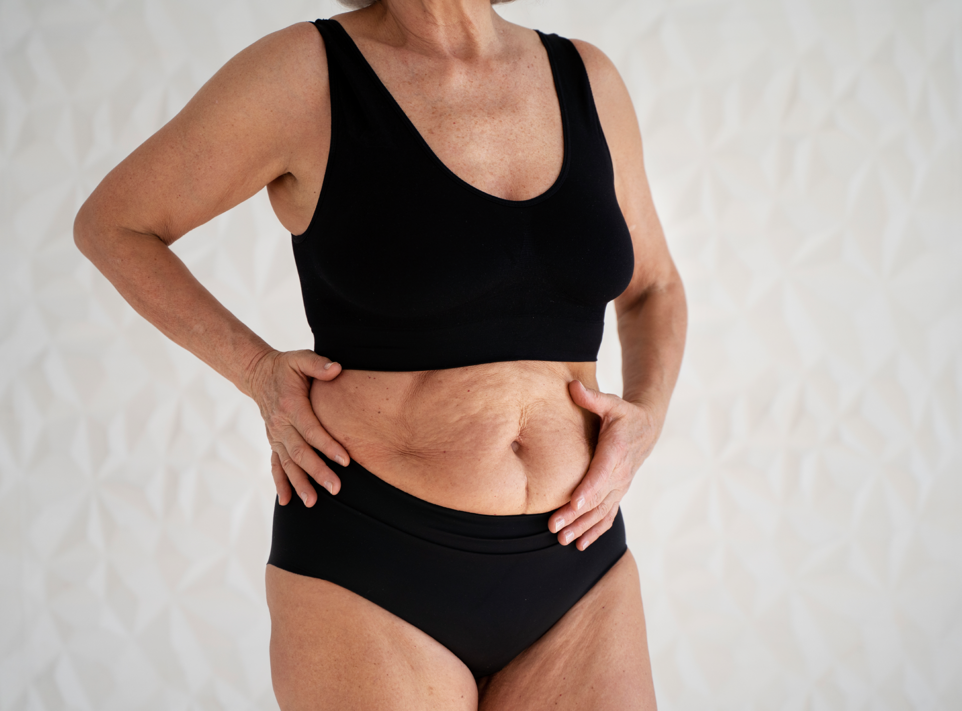 Where Can I Get a Tummy Tuck