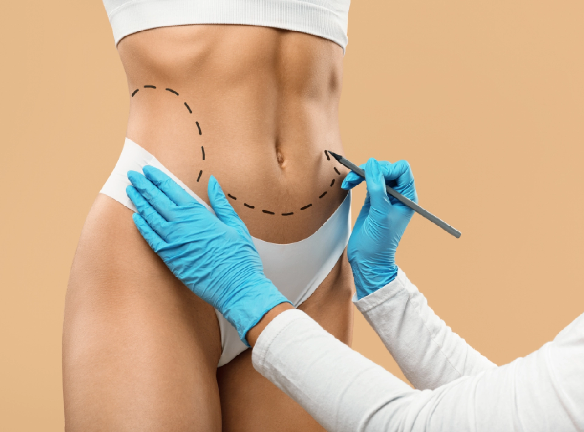 Tummy Tuck FAQ - Perfect Doctors Clinic