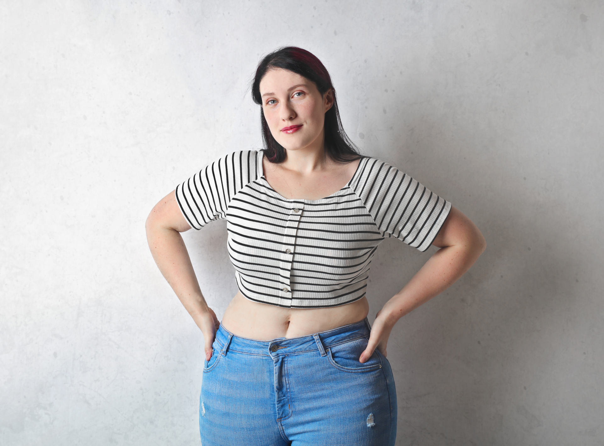 Alternatives to Liposuction