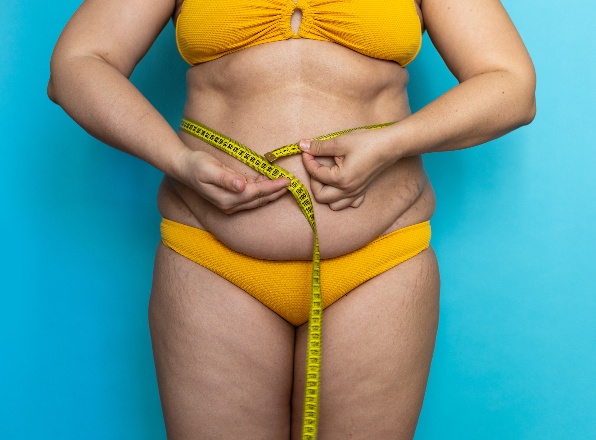 10 Myths About Liposuction