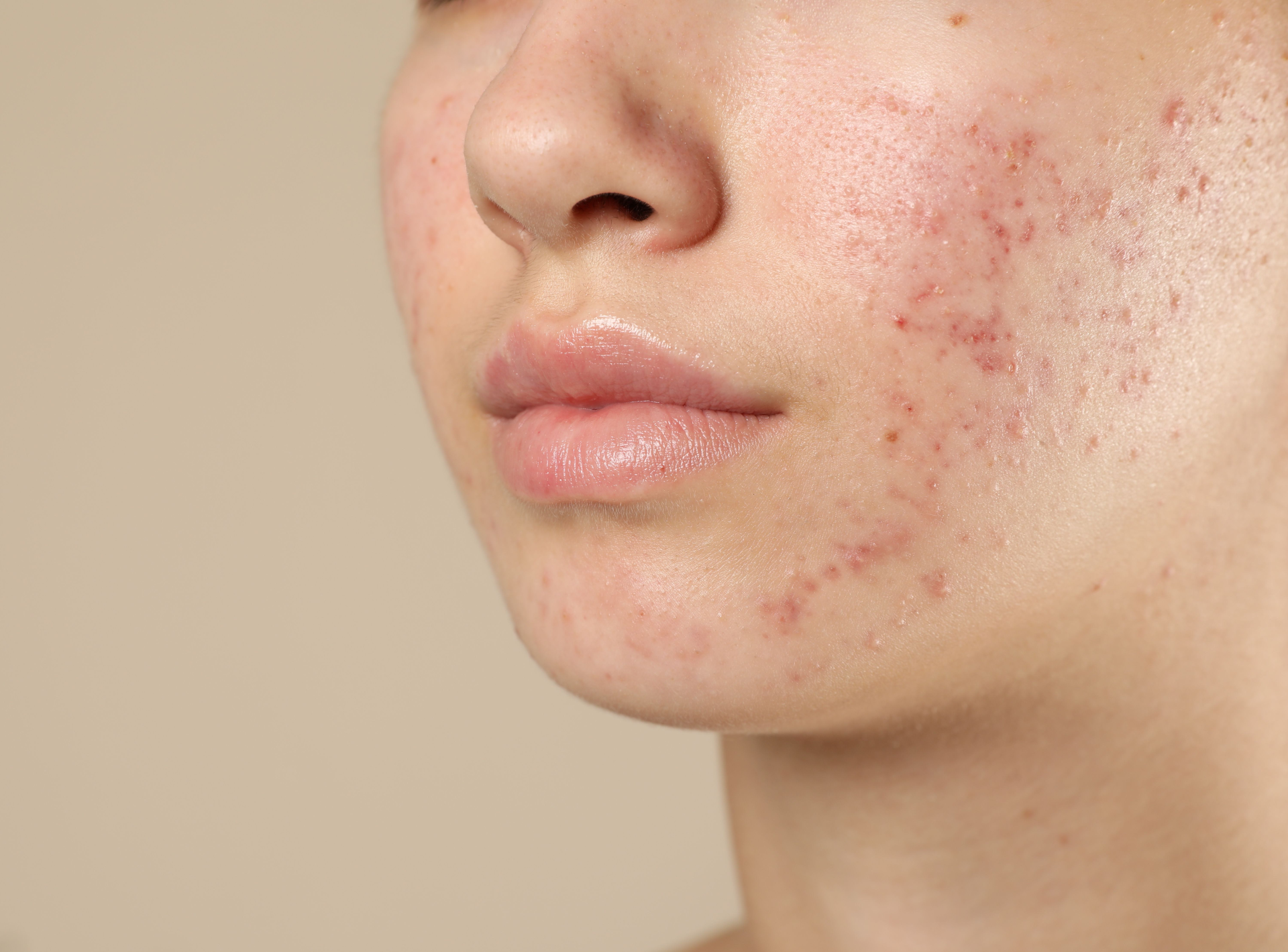 a Complete Guide to Getting Smooth Skin