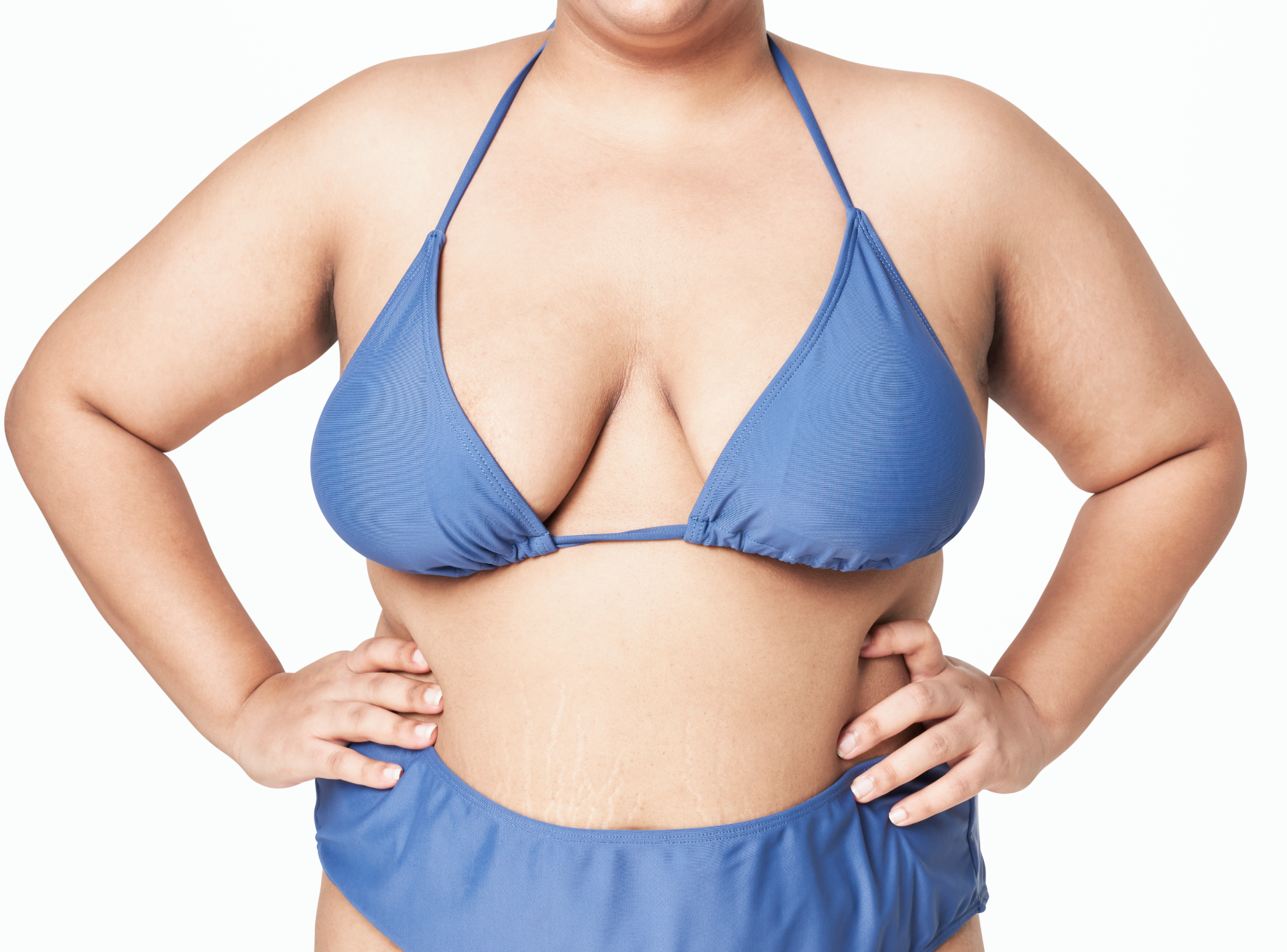 10 Breast Lift Recovery Tips