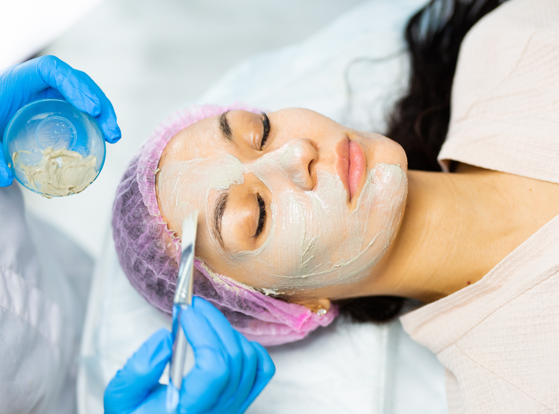 Which is Better Carbon Laser or Chemical Peel?