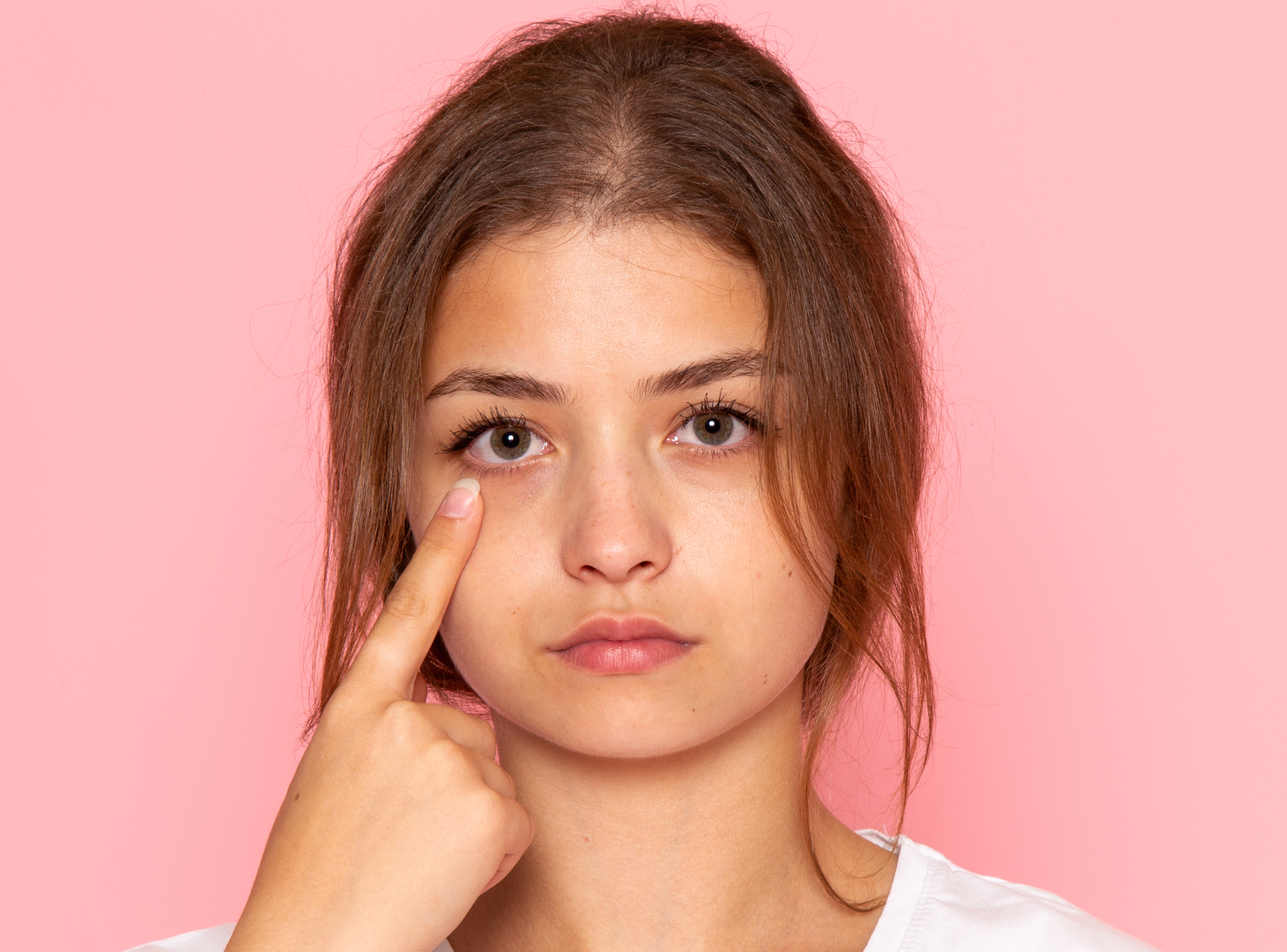 Effective Dark Circle Treatment That Actually Works